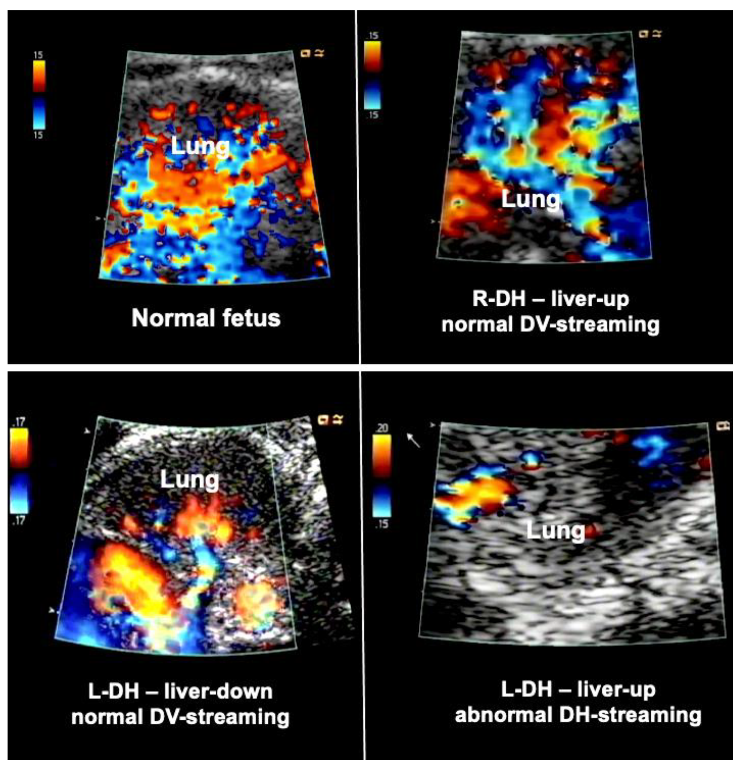 Children 10 00067 g003