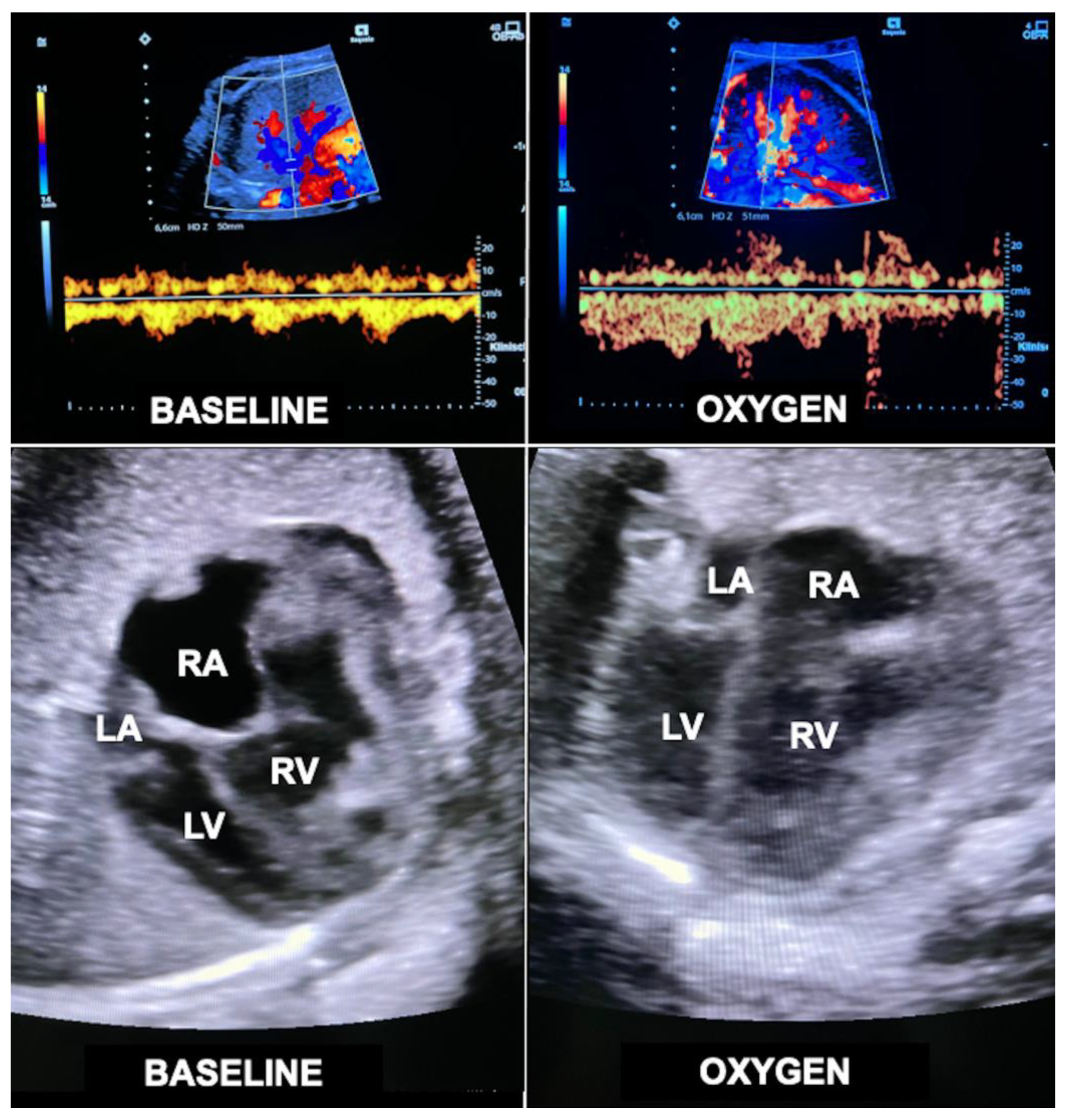 Children 10 00067 g011