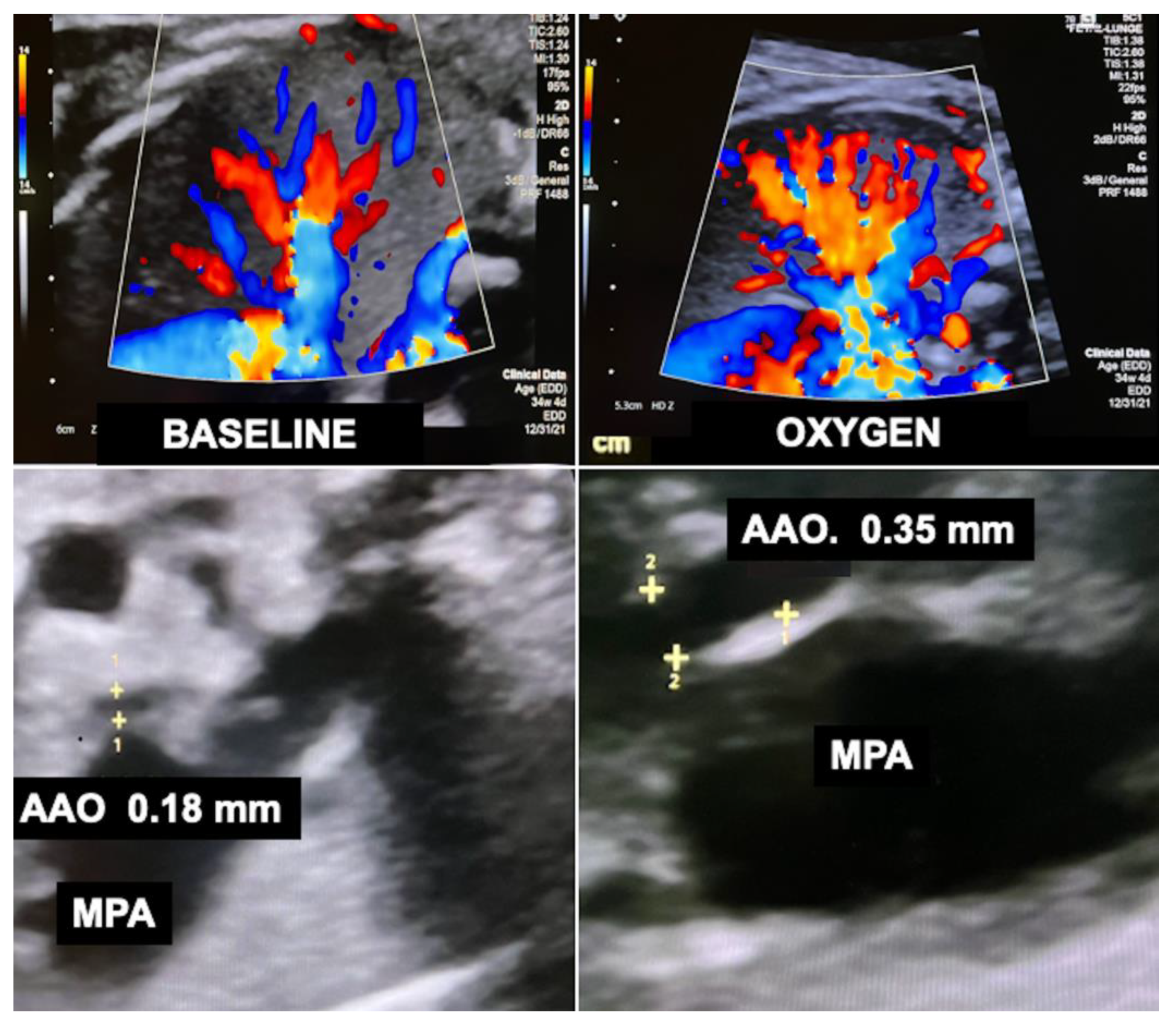 Children 10 00067 g012