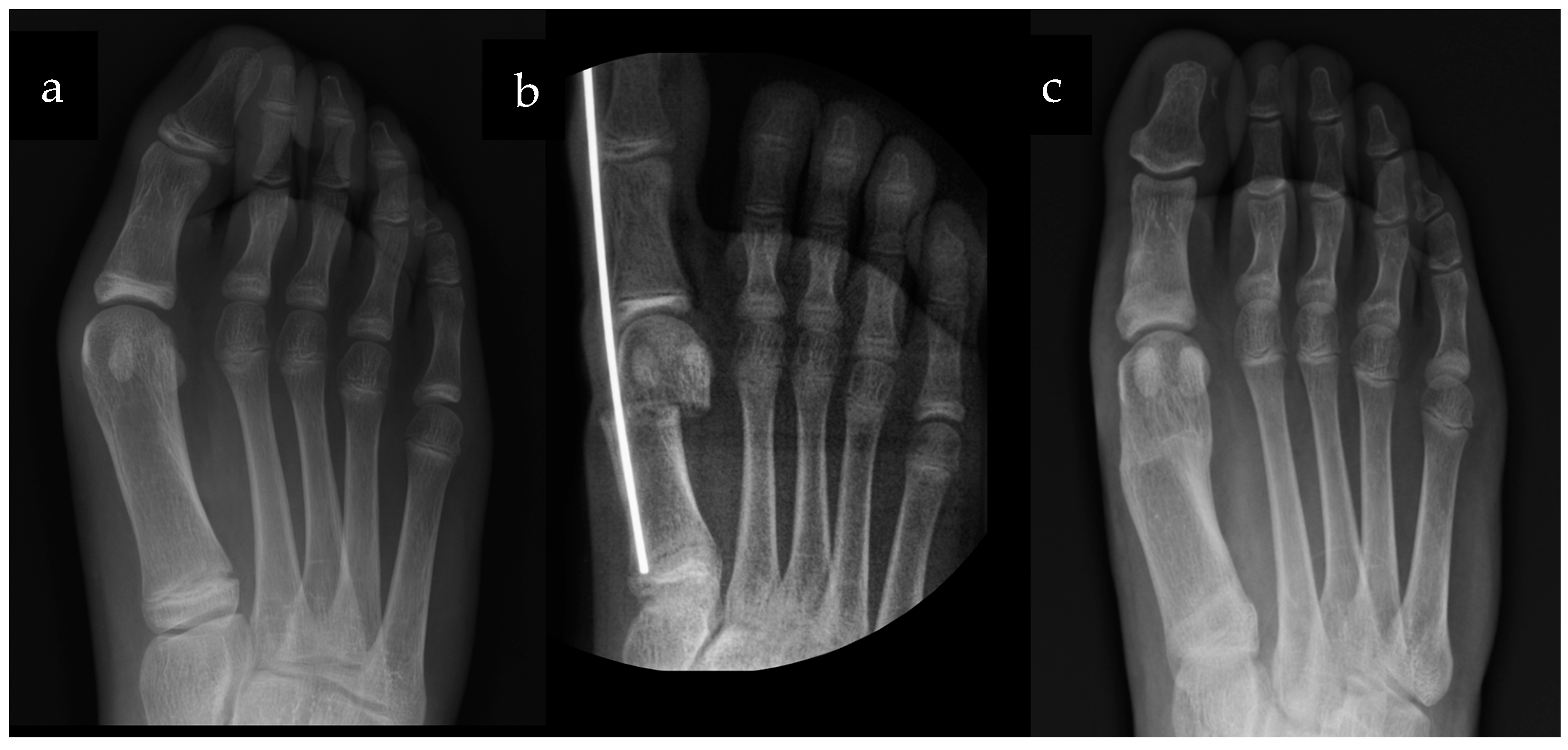 Children 10 00094 g003