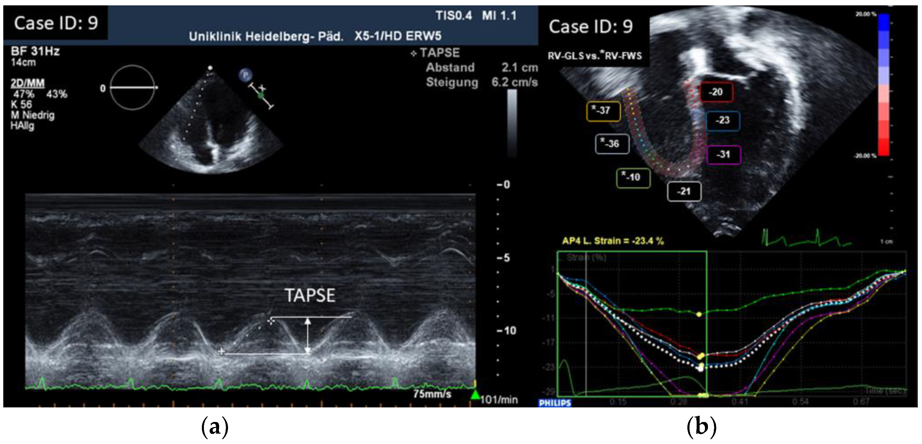 Children 10 00113 g001