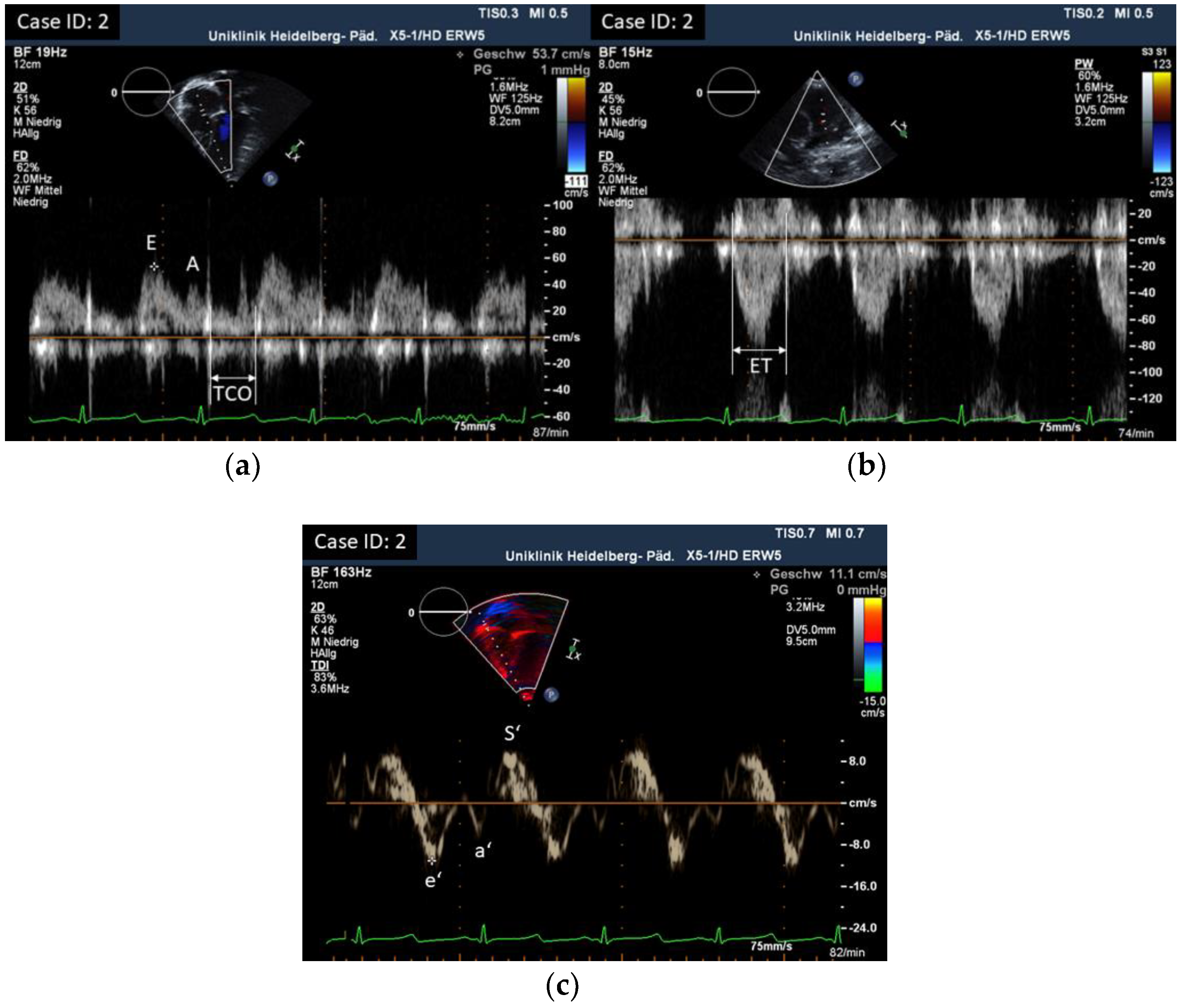 Children 10 00113 g003