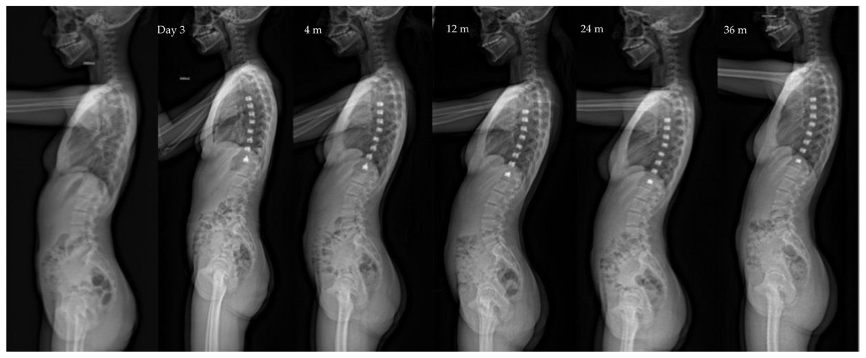 Children 10 00192 g002