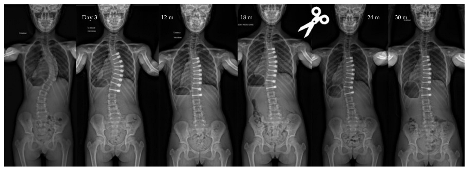 Children 10 00192 g004