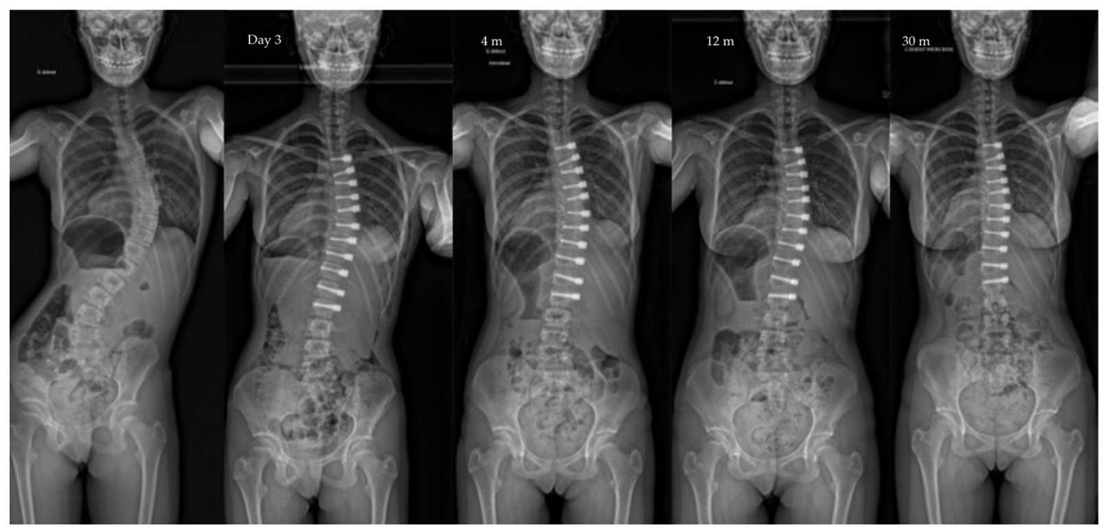 Children 10 00192 g005