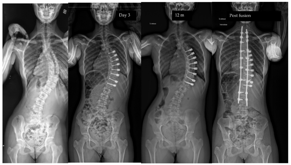 Children 10 00192 g007