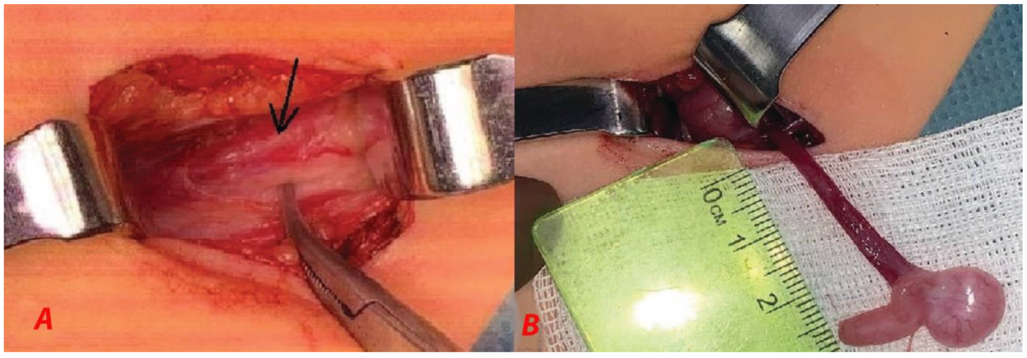 Children 10 00205 g003