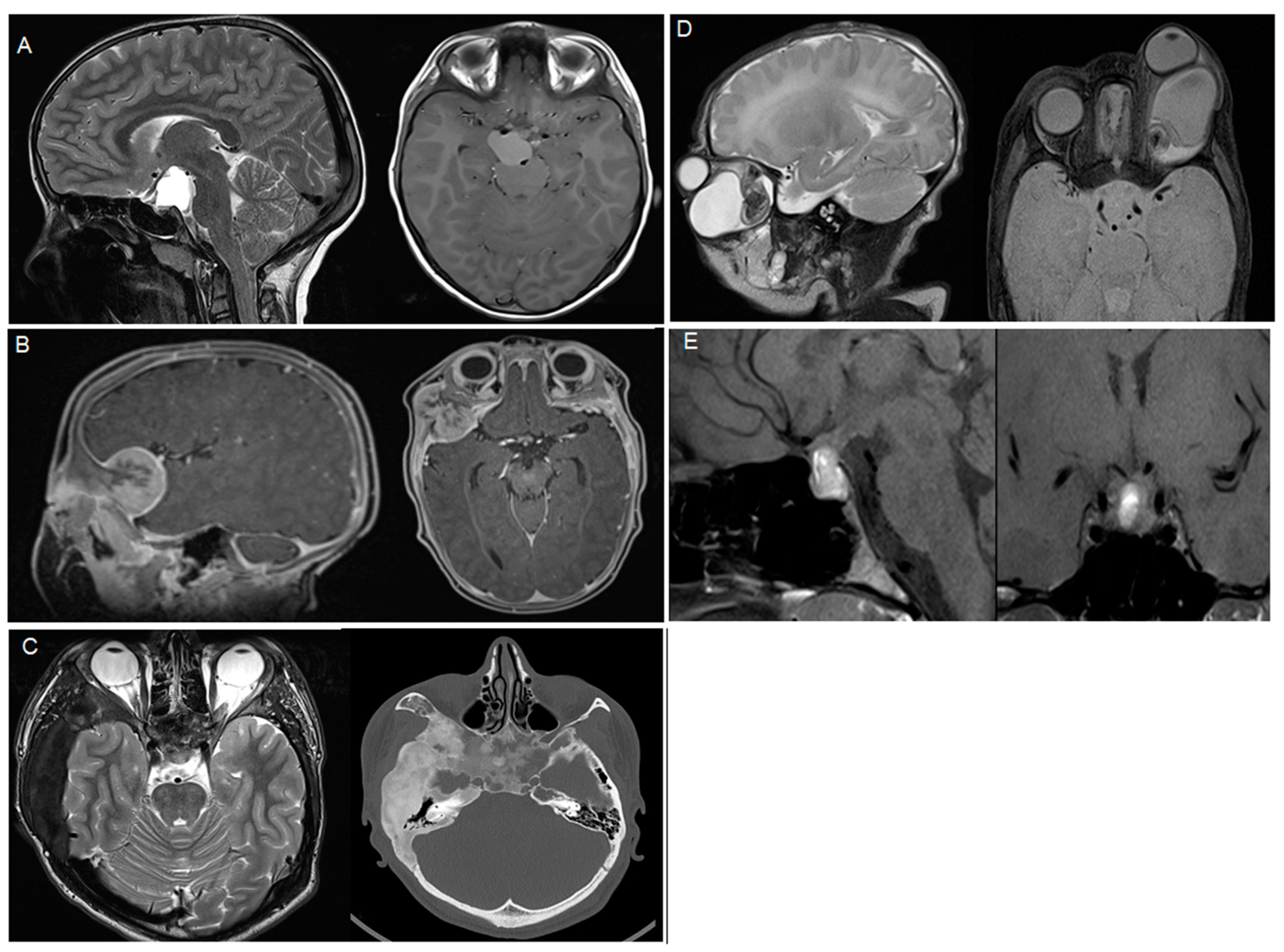 Children 10 00216 g001