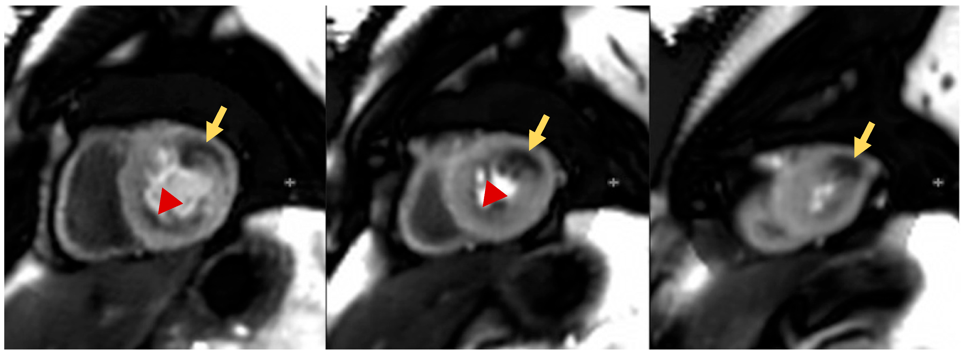 Children 10 00218 g003