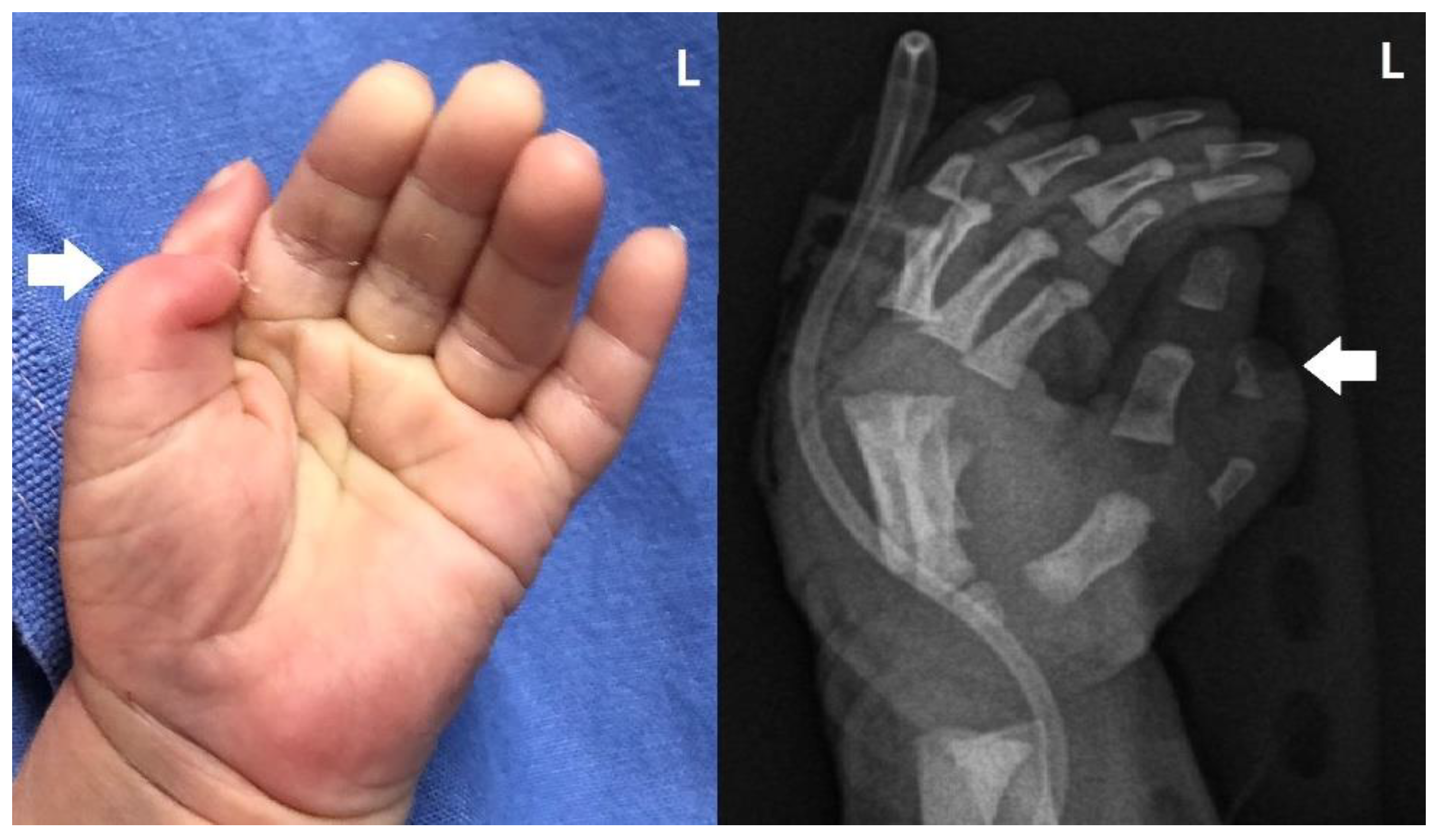 Children 10 00228 g003