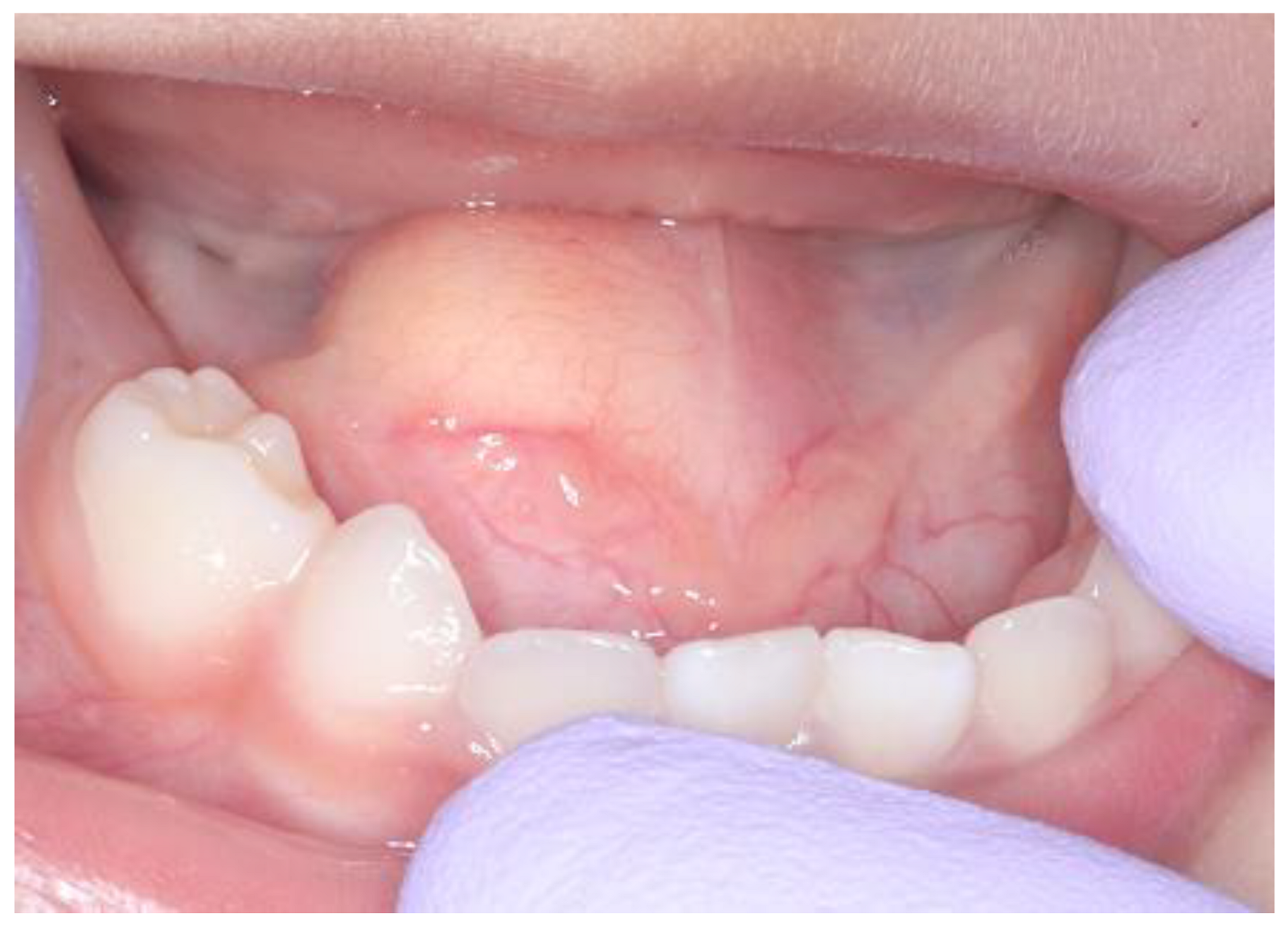 Children 10 00254 g001