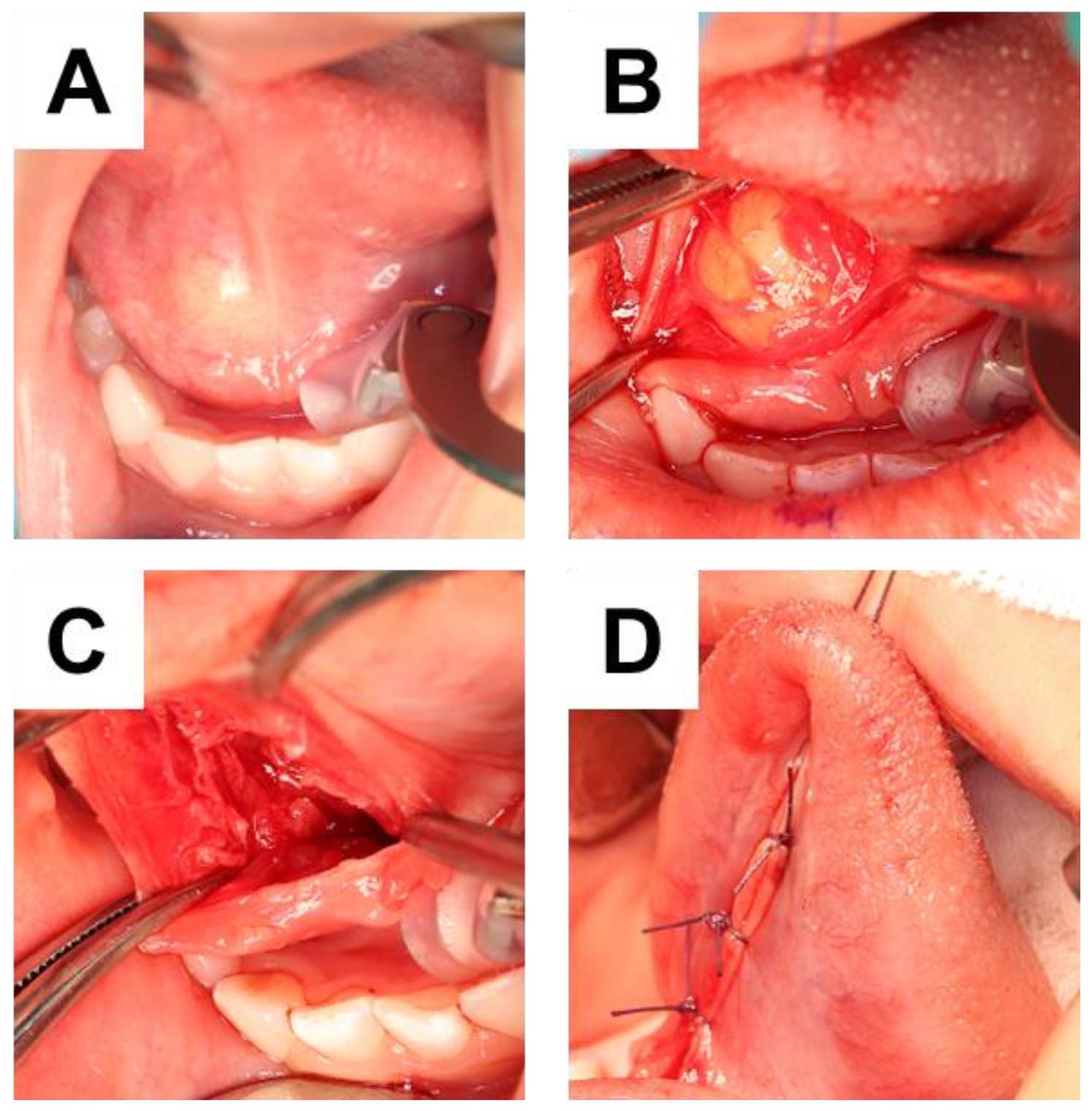 Children 10 00254 g003