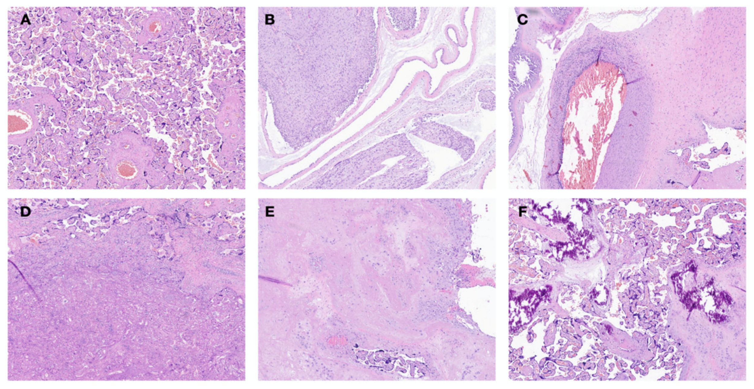 Children 10 00289 g003