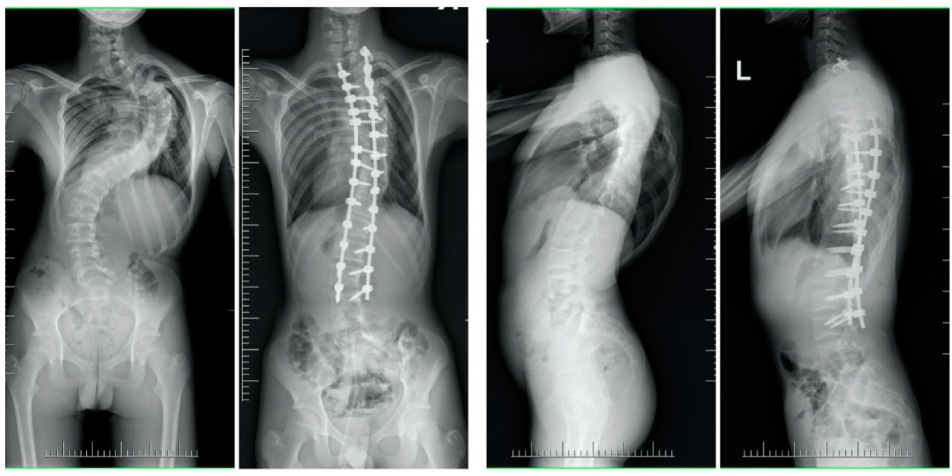 Children 10 00299 g002