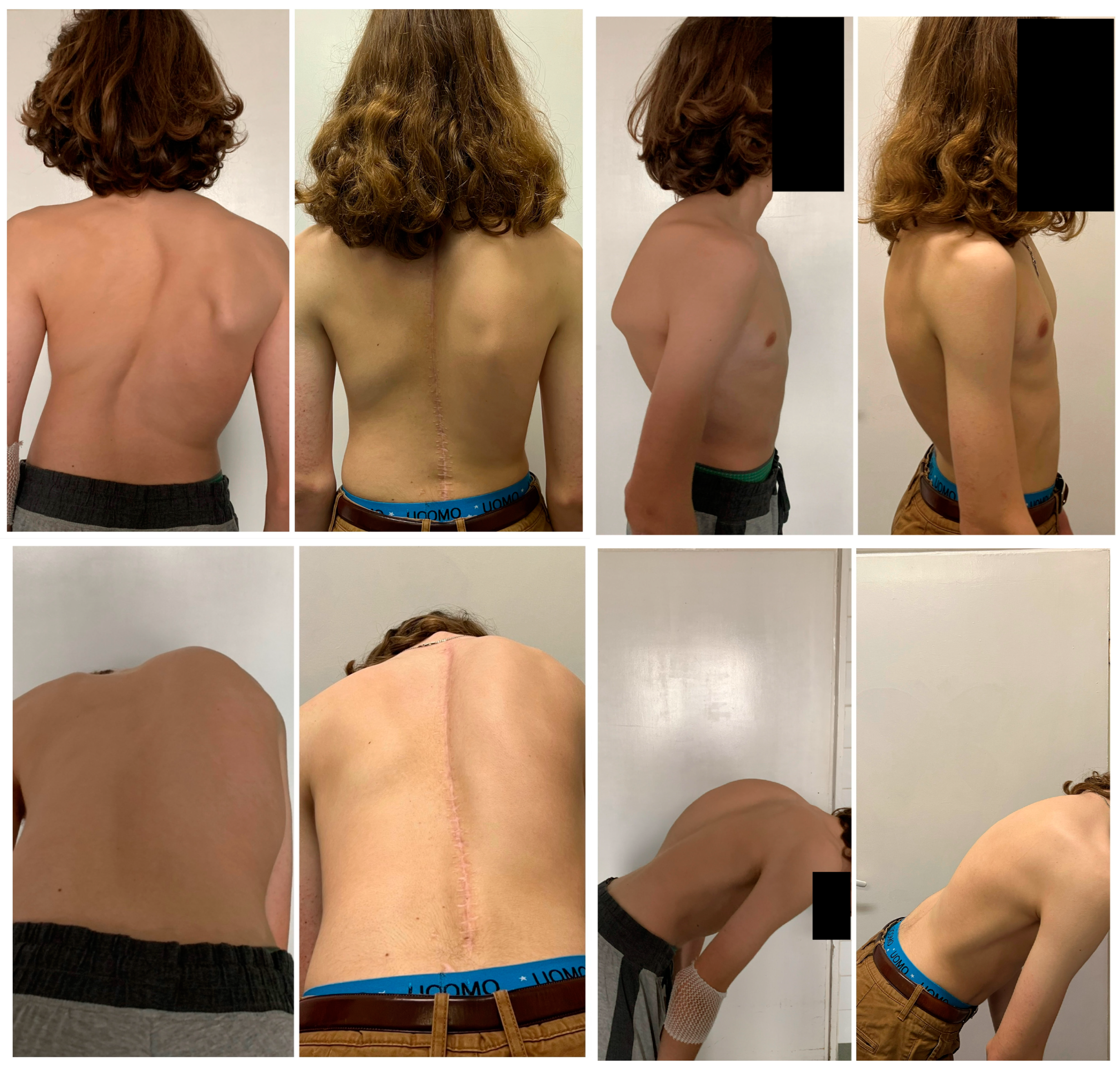 Children 10 00299 g003