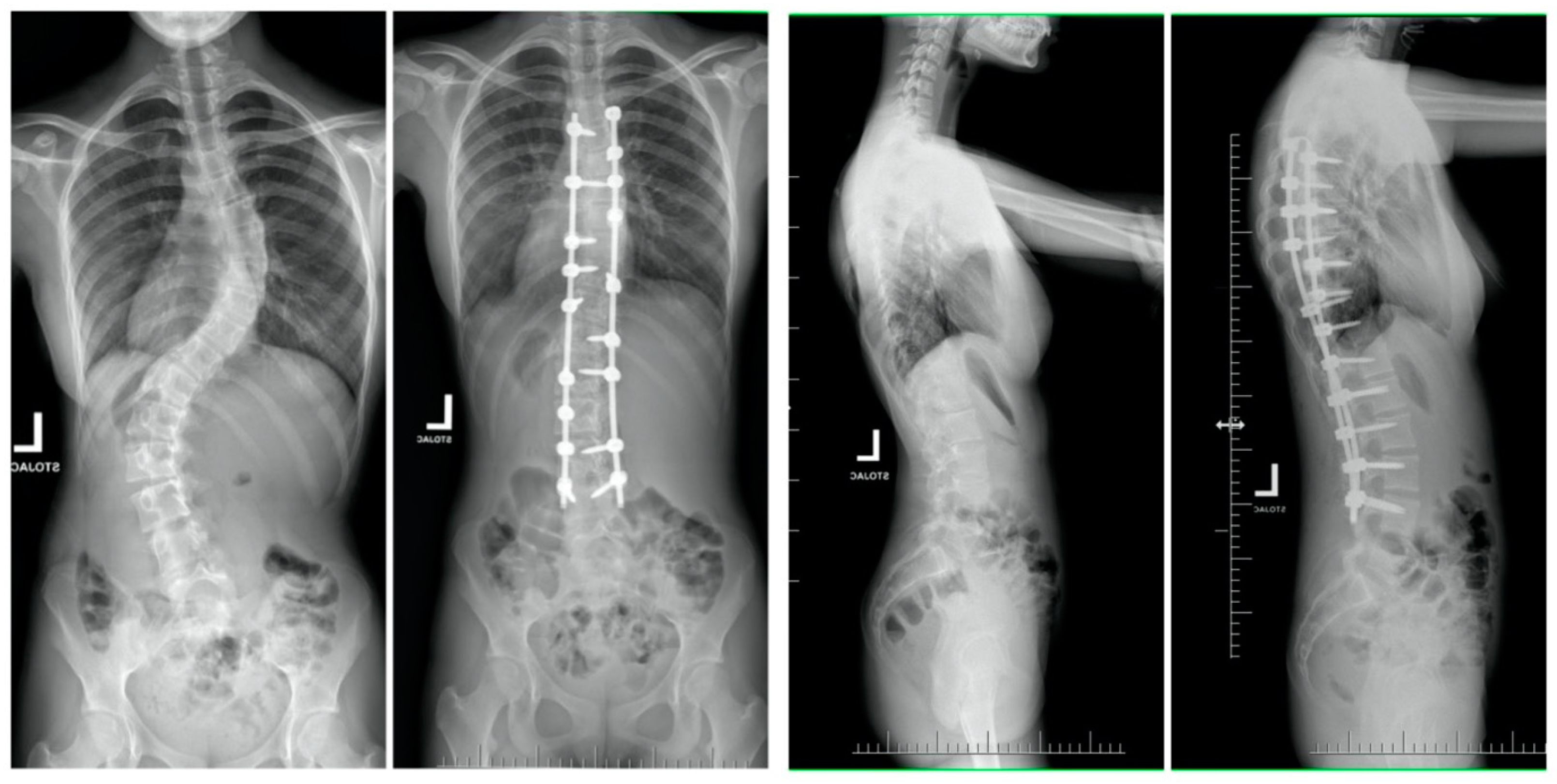 Children 10 00299 g004