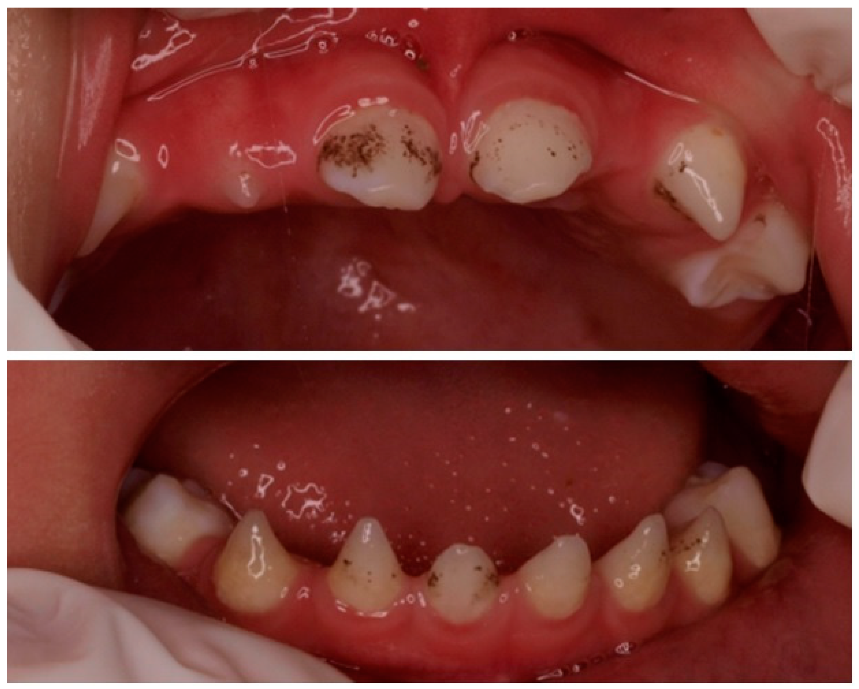 Children 10 00356 g001