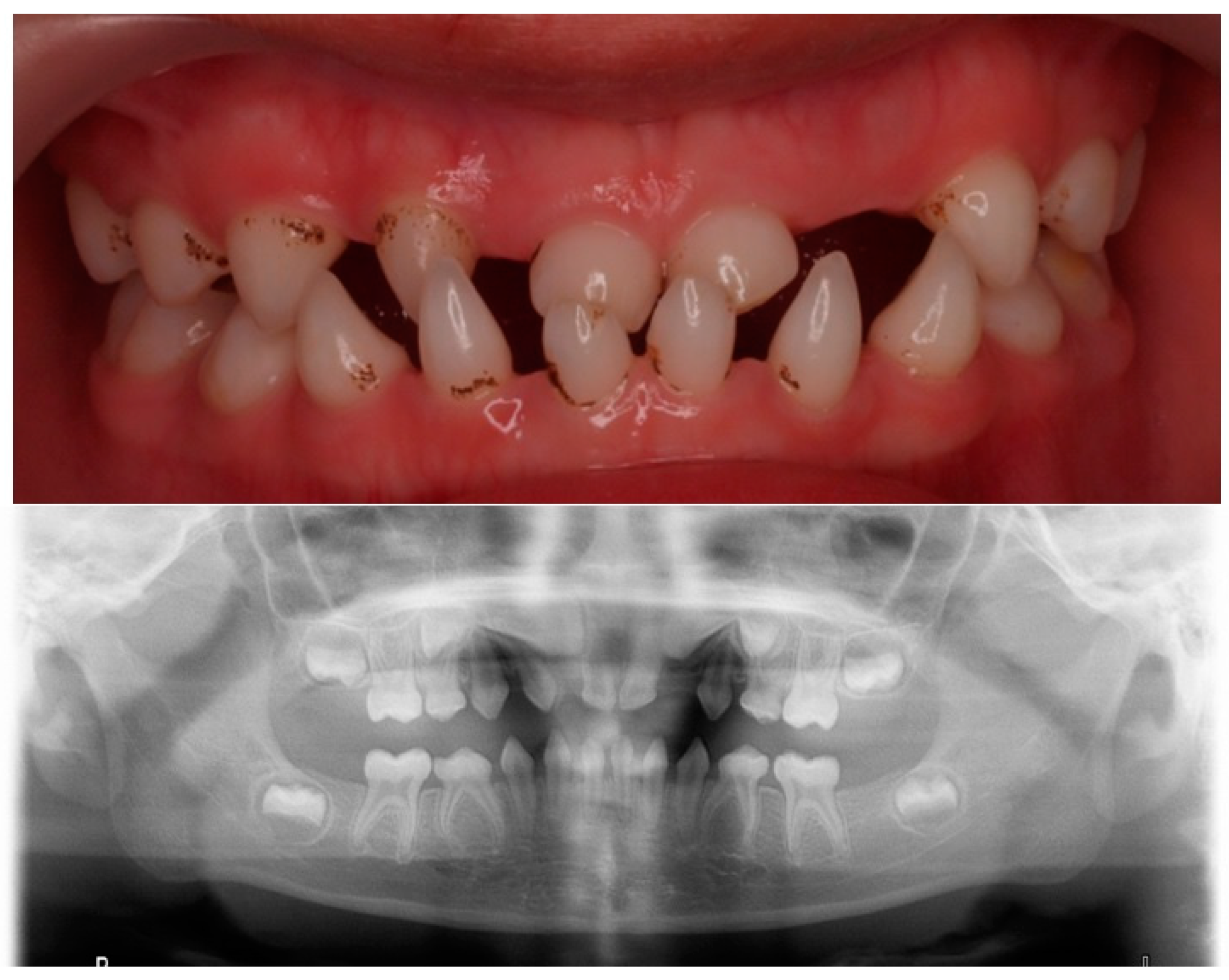 Children 10 00356 g002