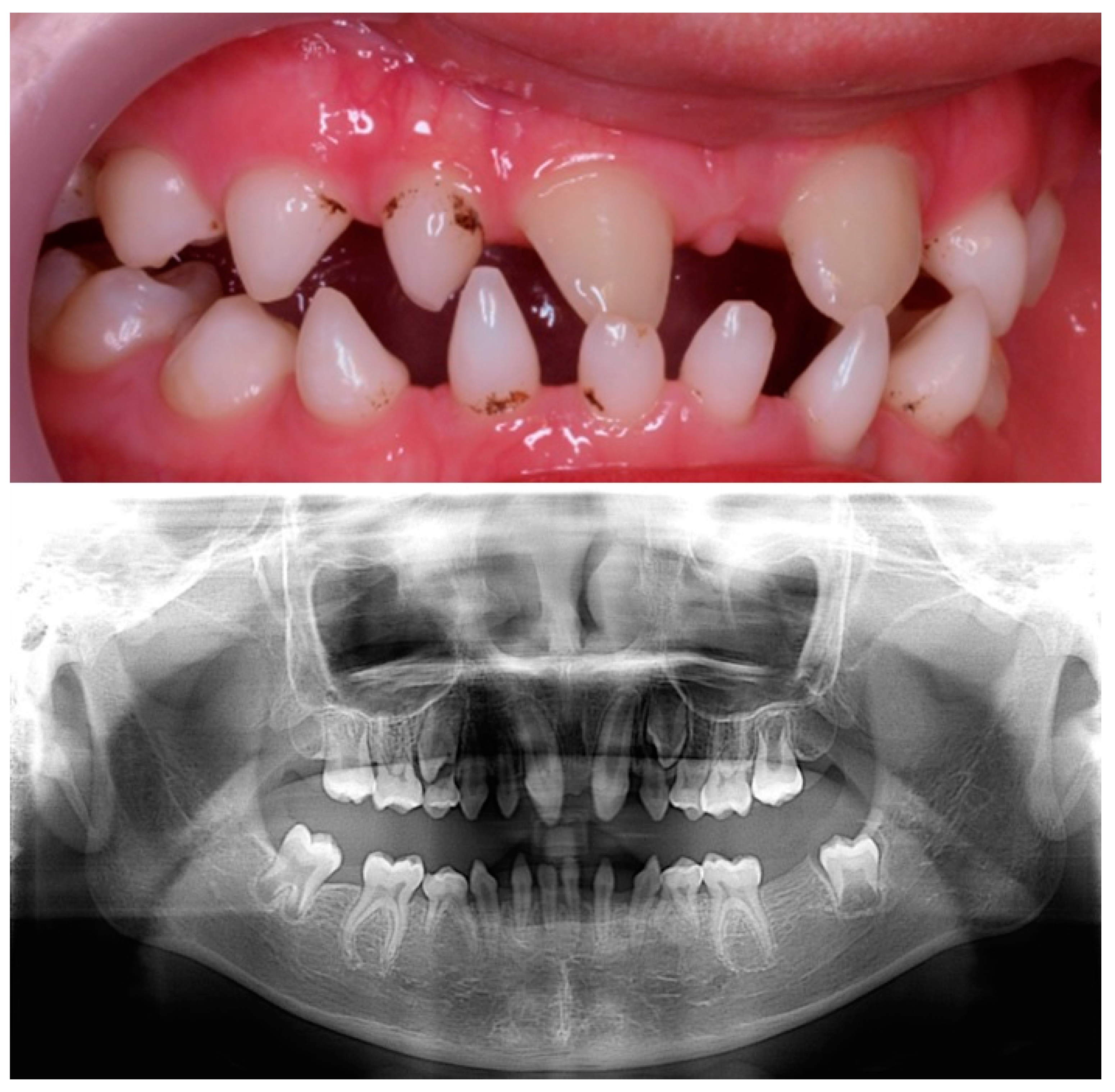 Children 10 00356 g003