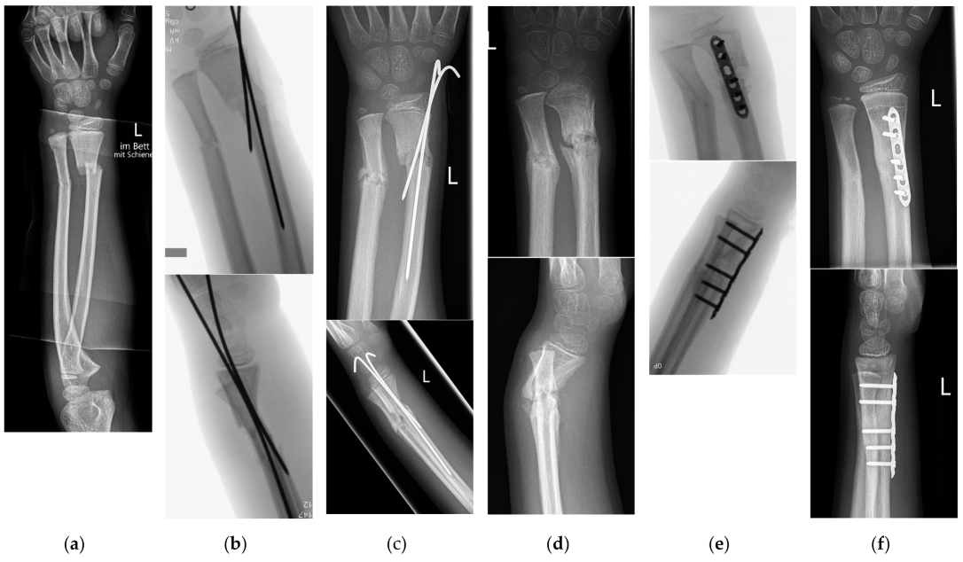 Children 10 00374 g006