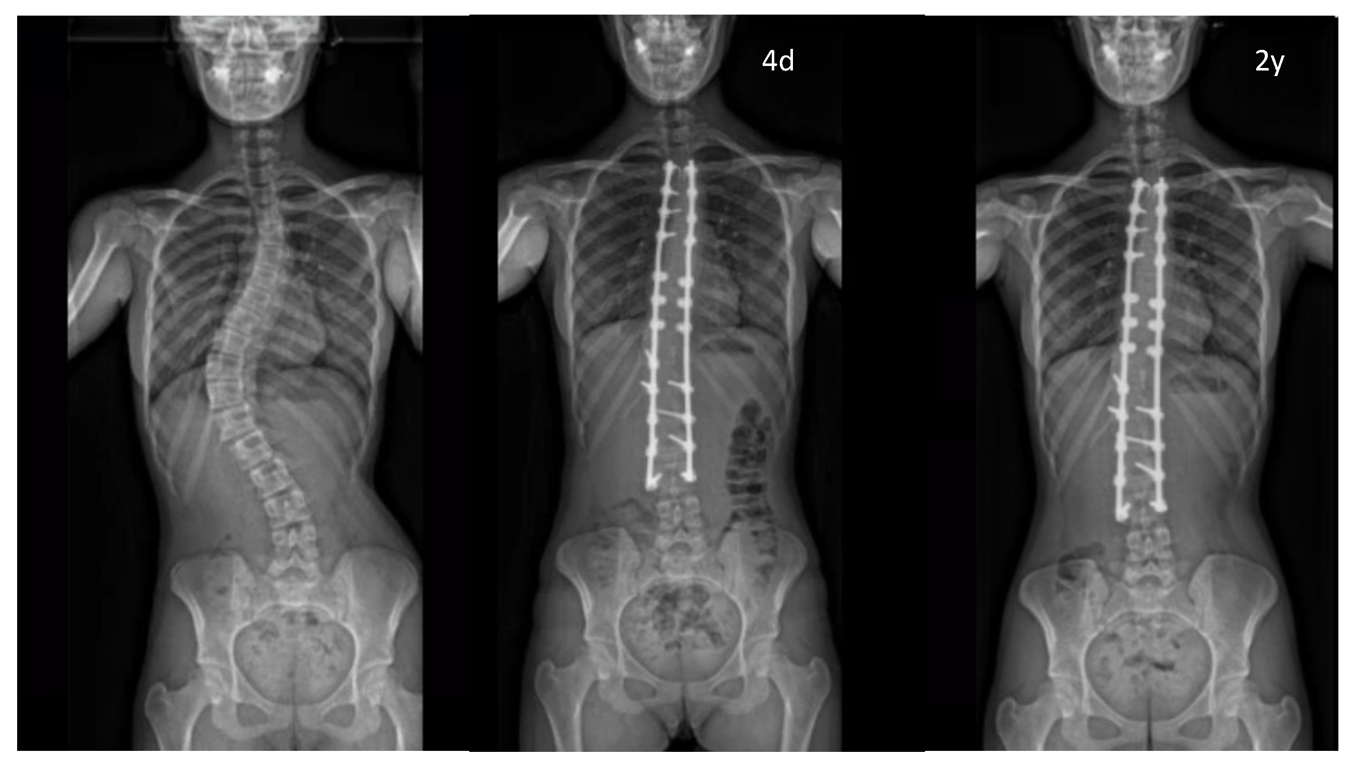 Children 10 00398 g004