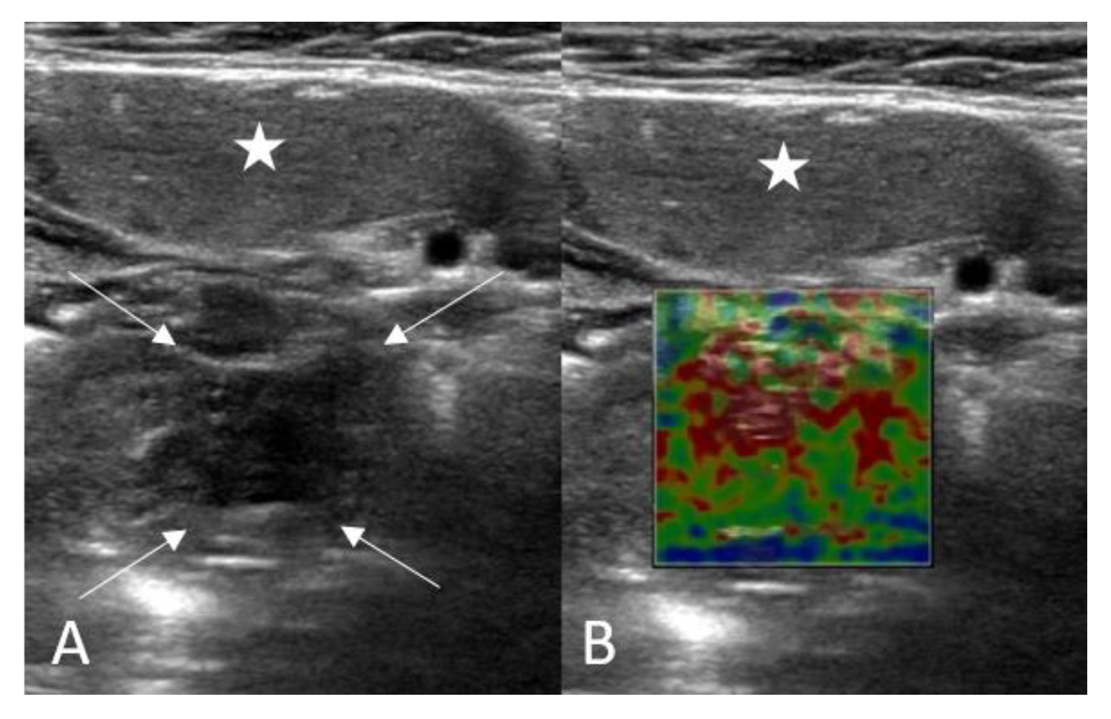 Children 10 00704 g002 Children 10 00704 g002