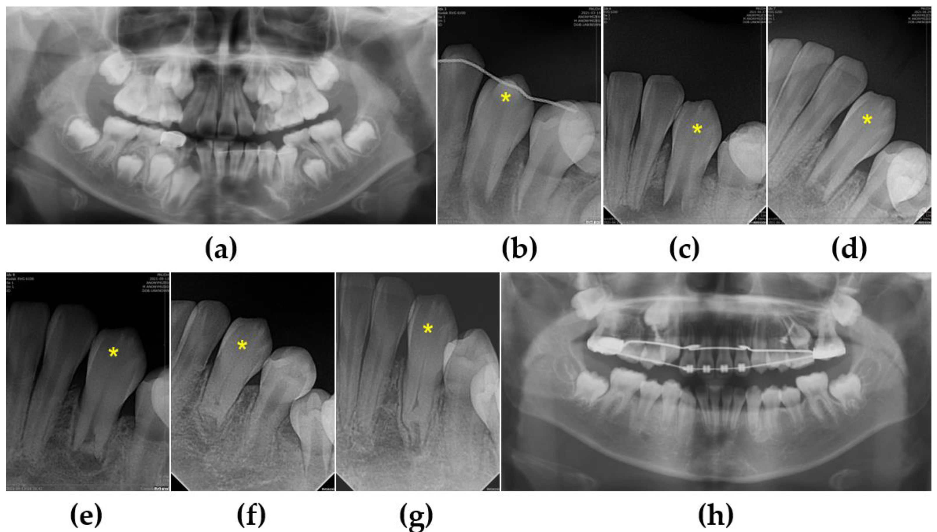 Children 10 00708 g004