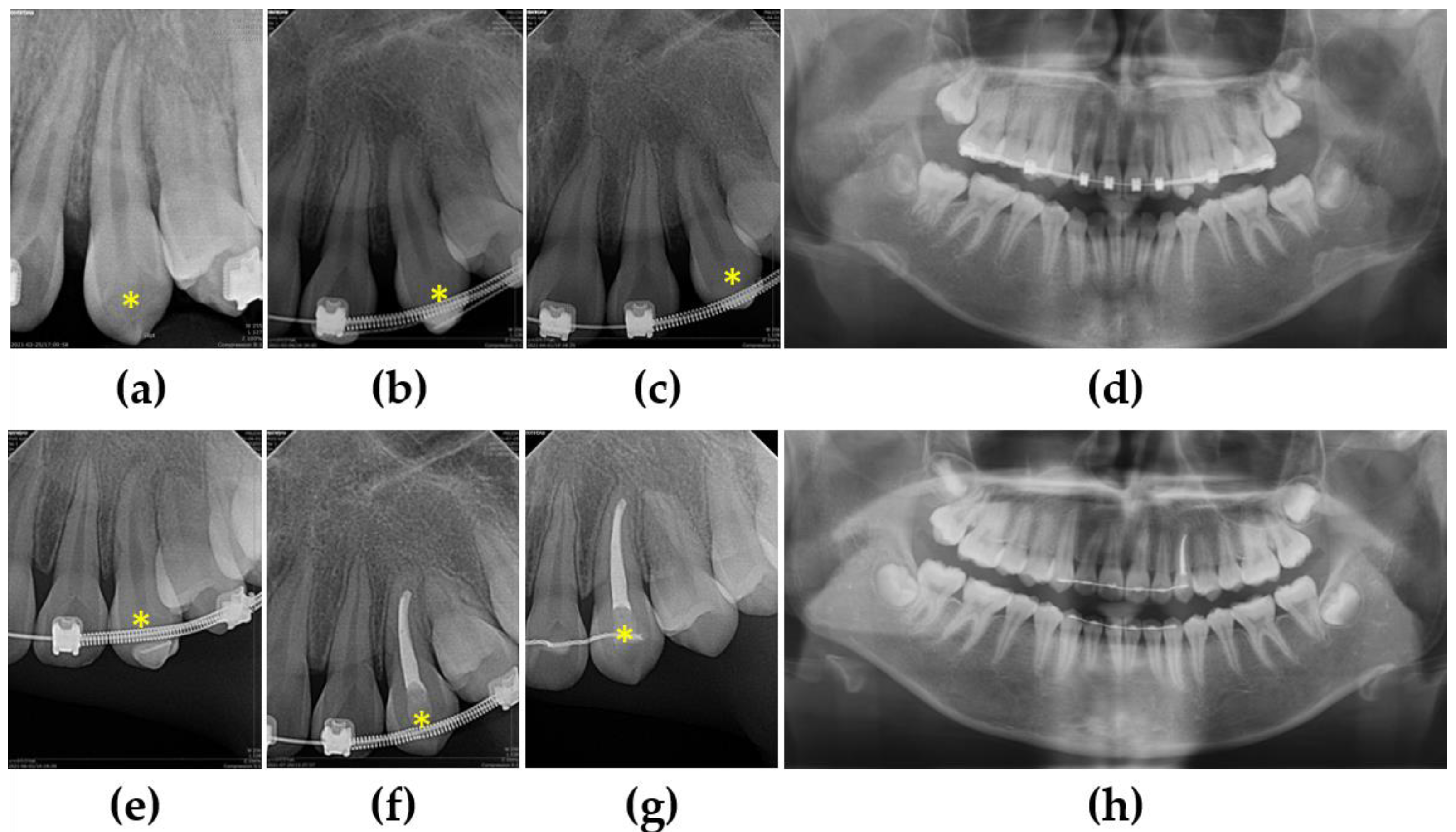 Children 10 00708 g008