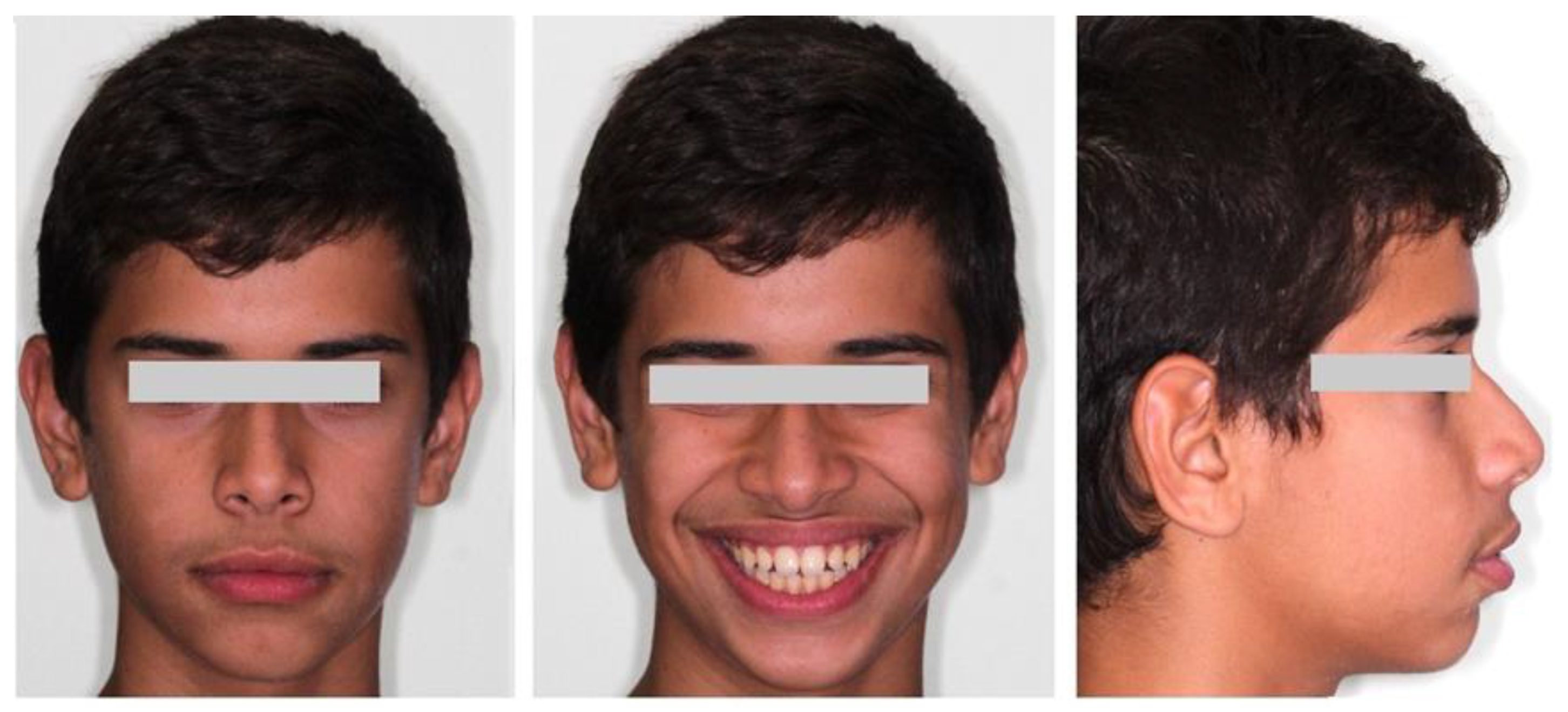 Children 10 00879 g001