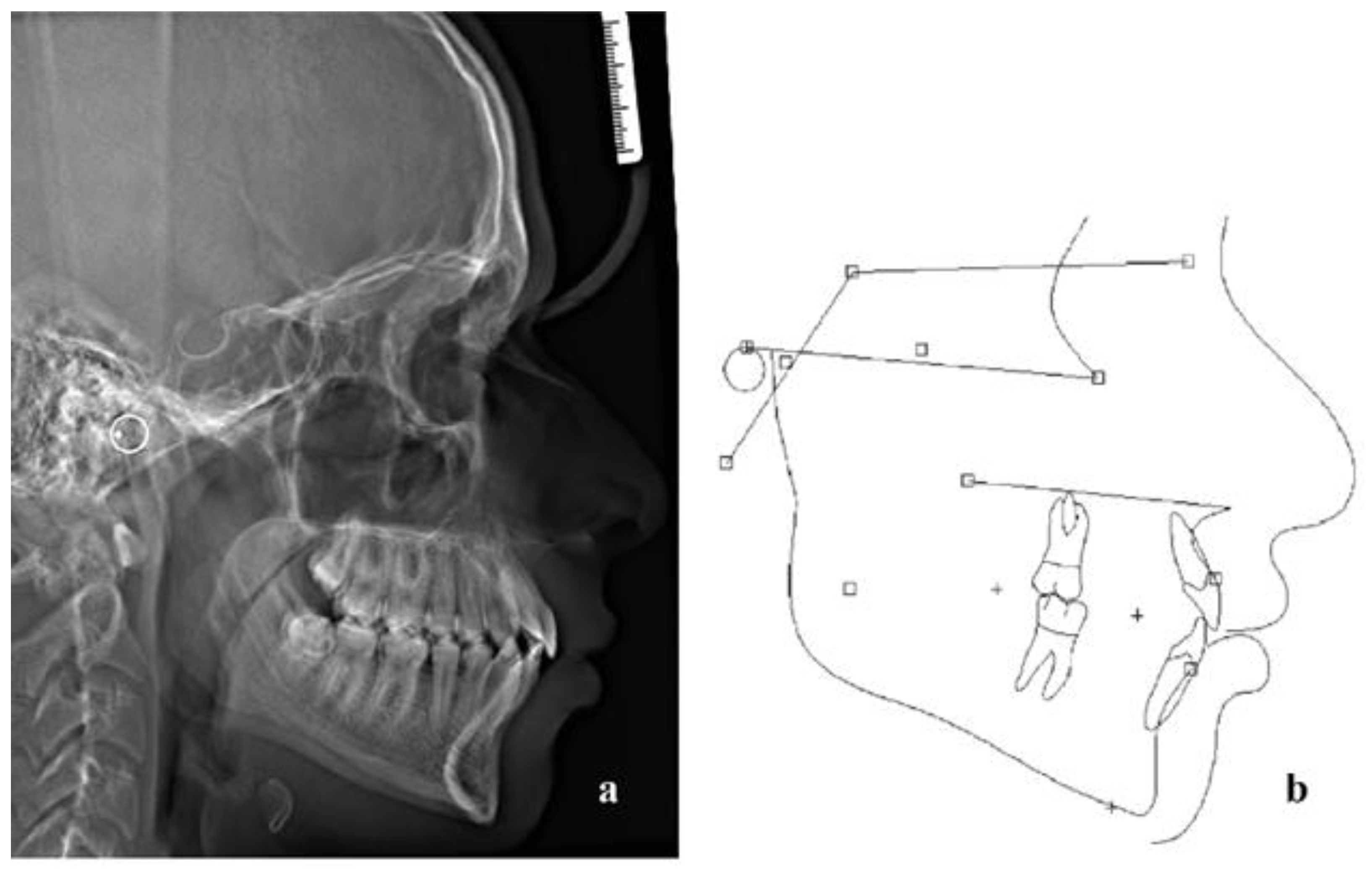 Children 10 00879 g012