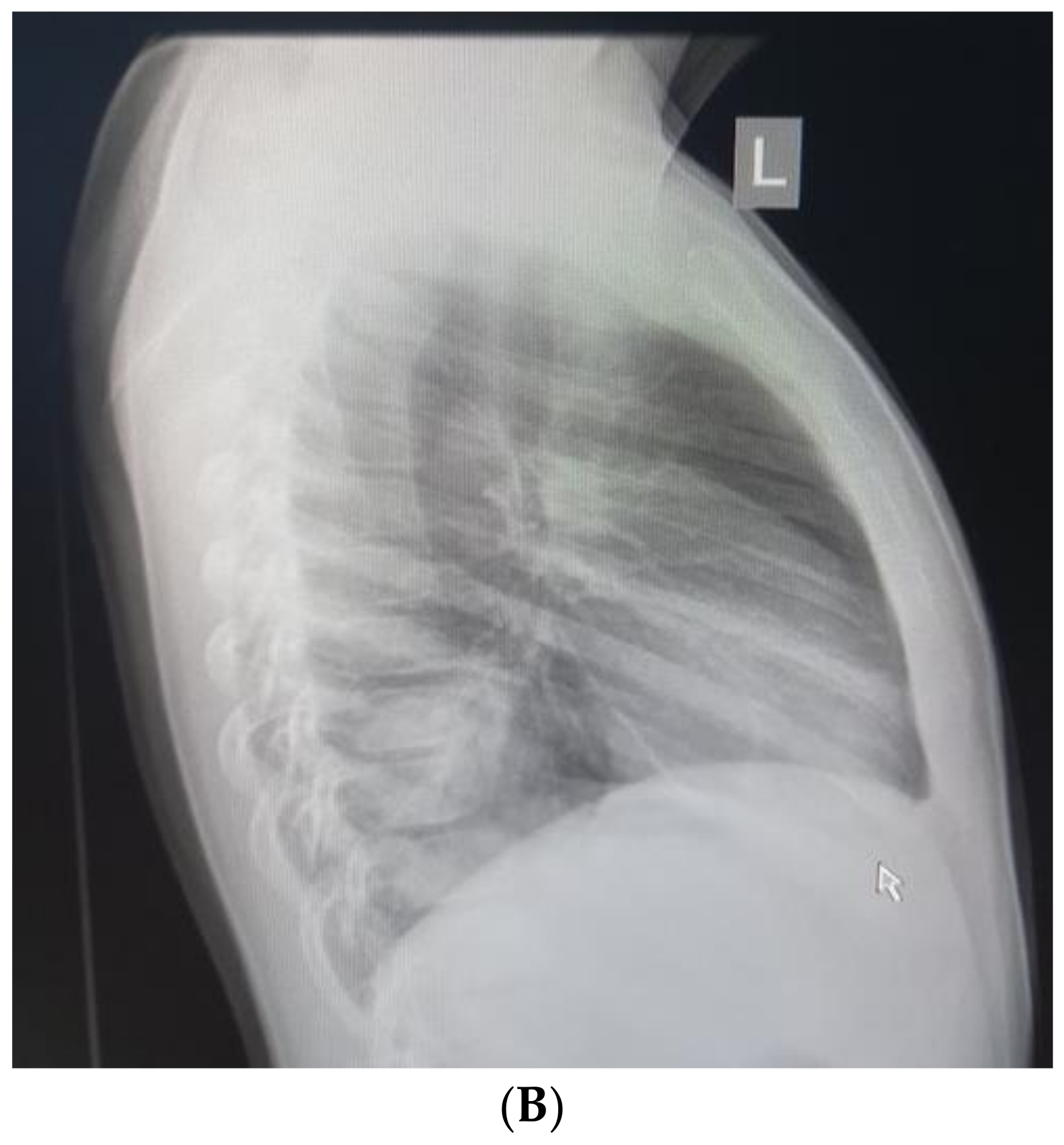 Children 10 00910 g001b