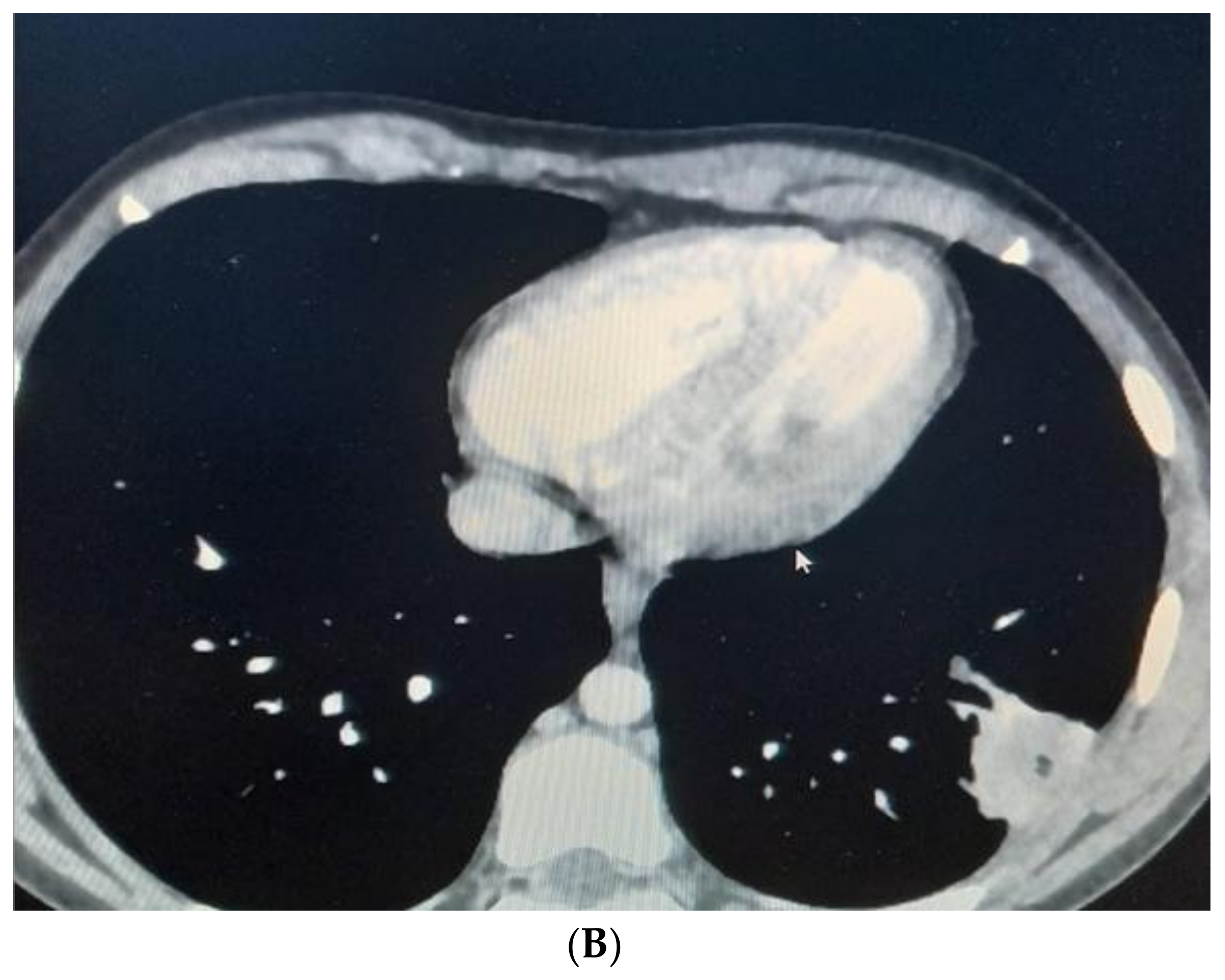 Children 10 00910 g004b