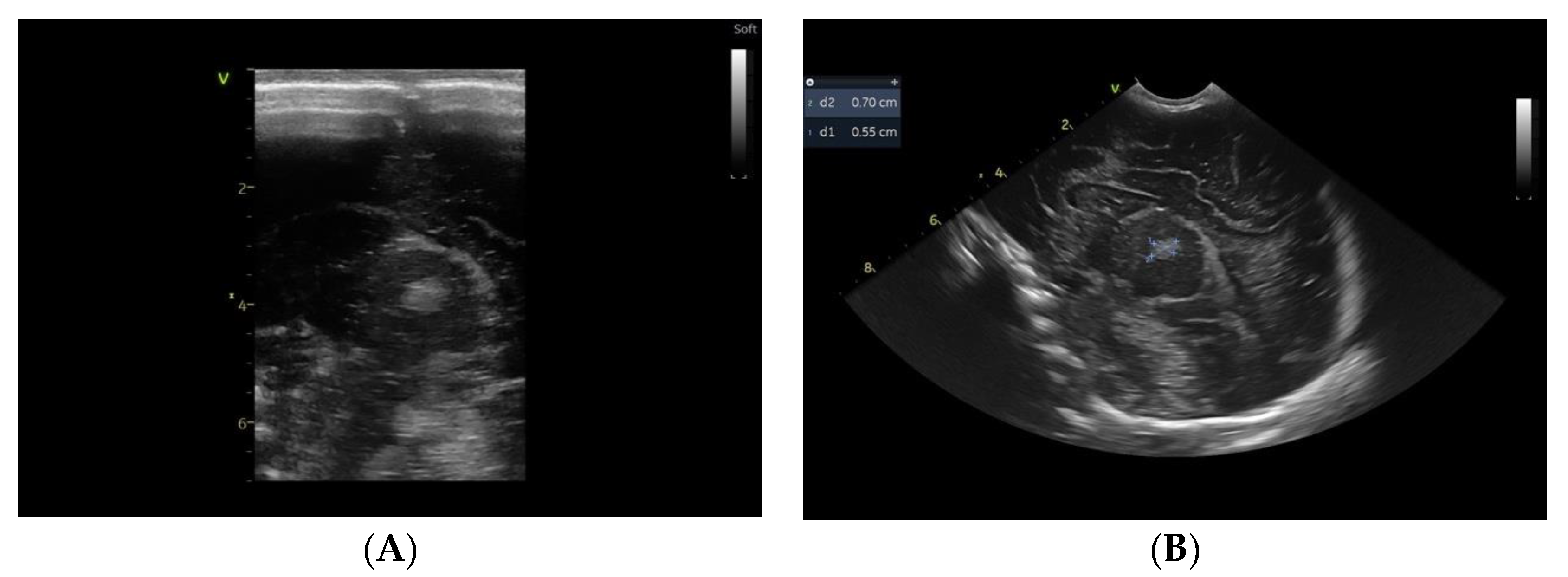 Children 10 00958 g004