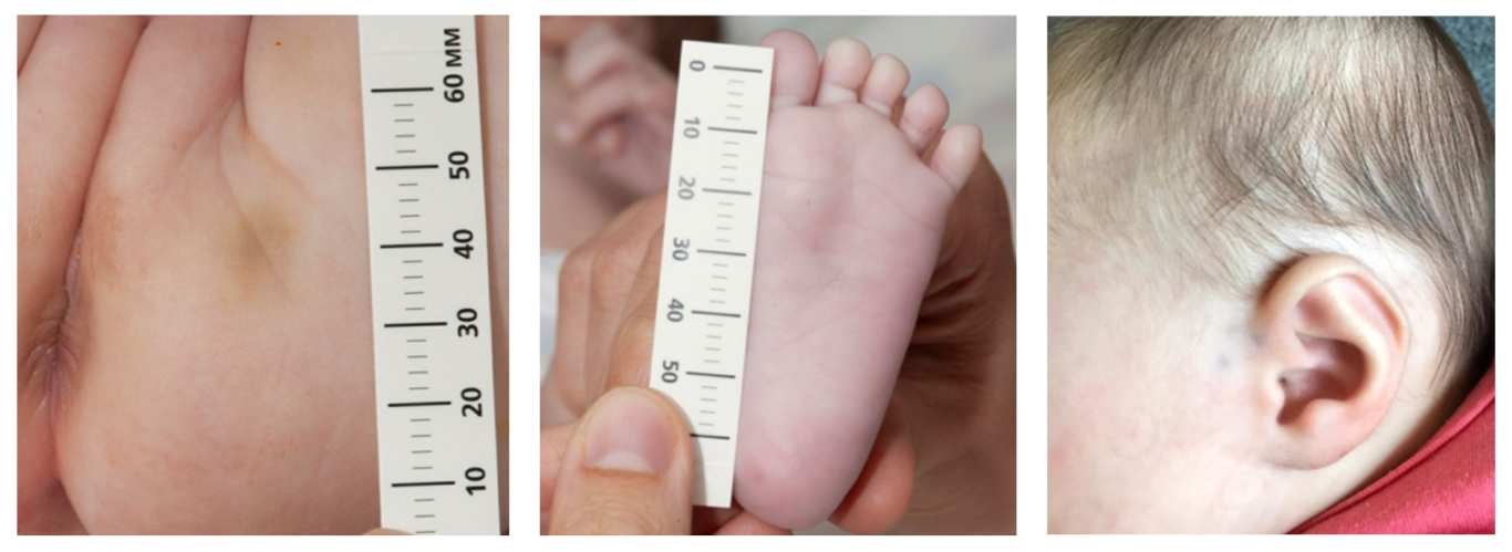 Children 10 00963 g001