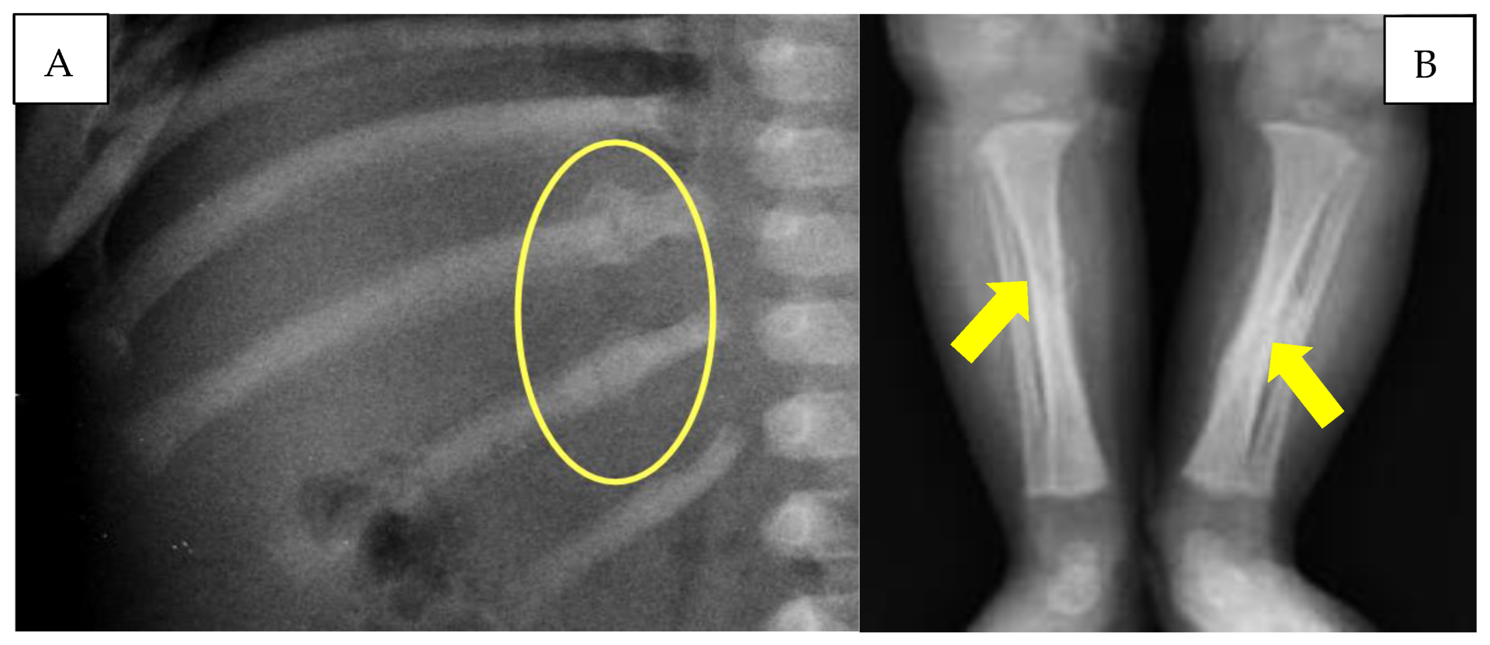 Children 10 01003 g004