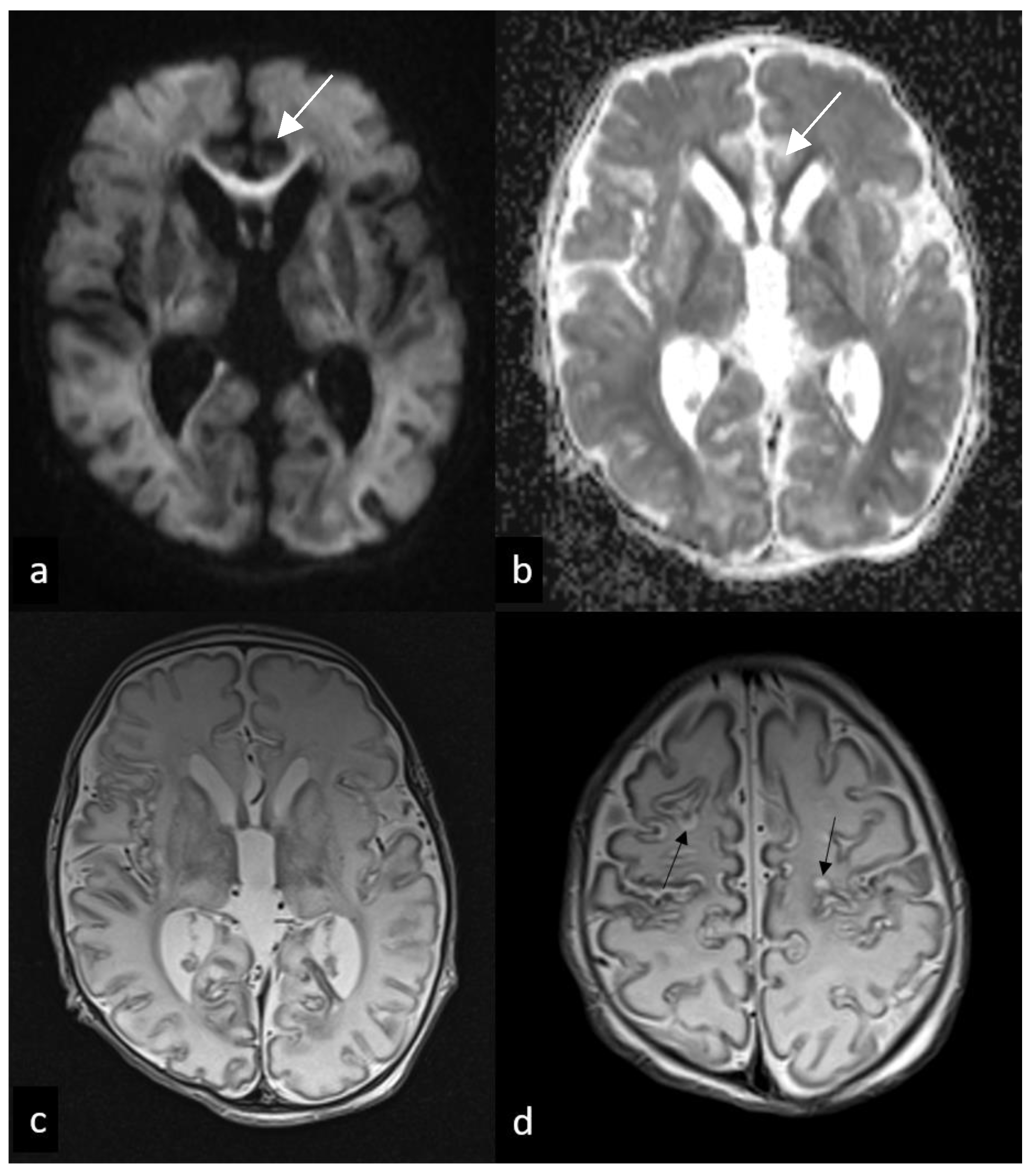 Children 10 01072 g003