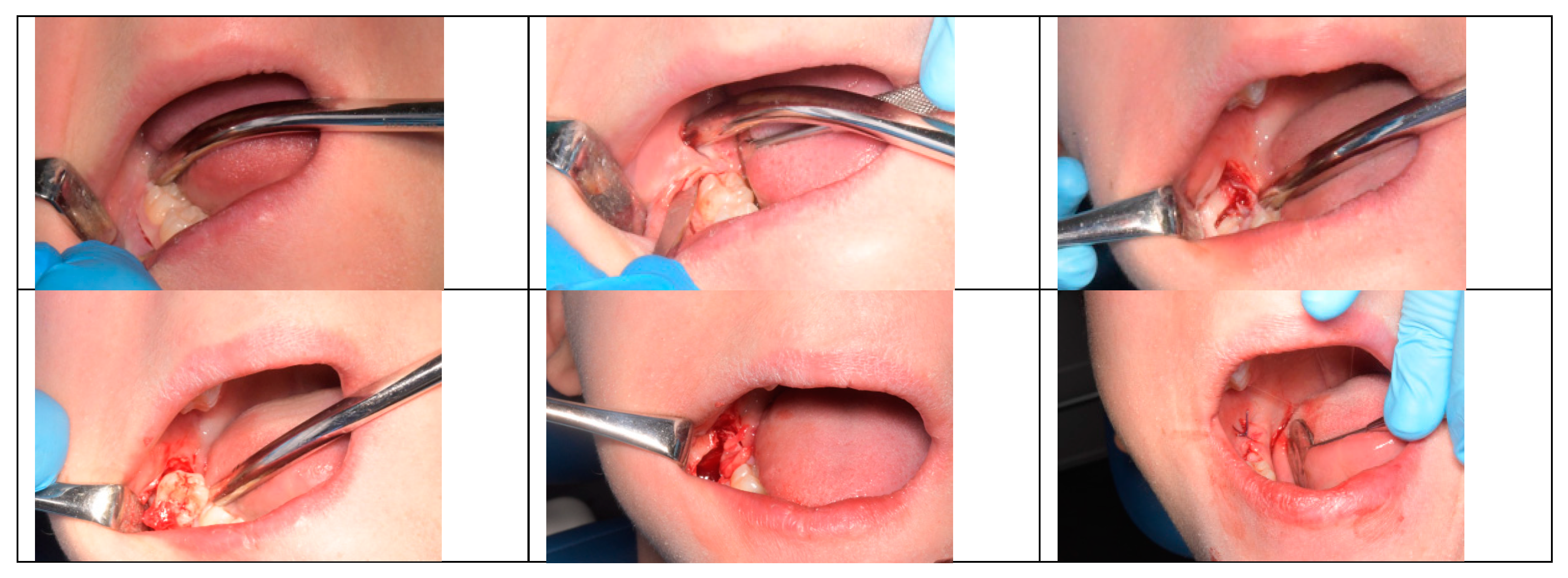 Children 10 01077 g002