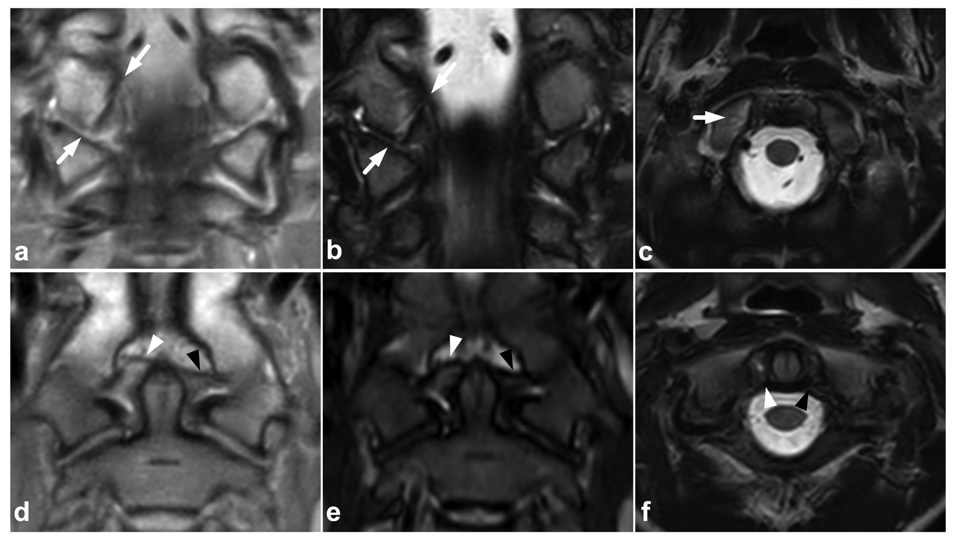 Children 10 01094 g004 Children 10 01094 g004