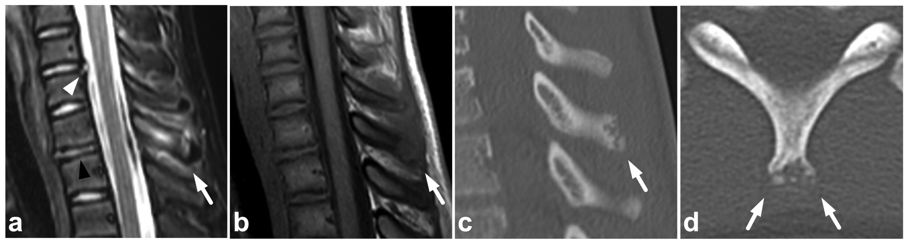 Children 10 01094 g005 Children 10 01094 g005