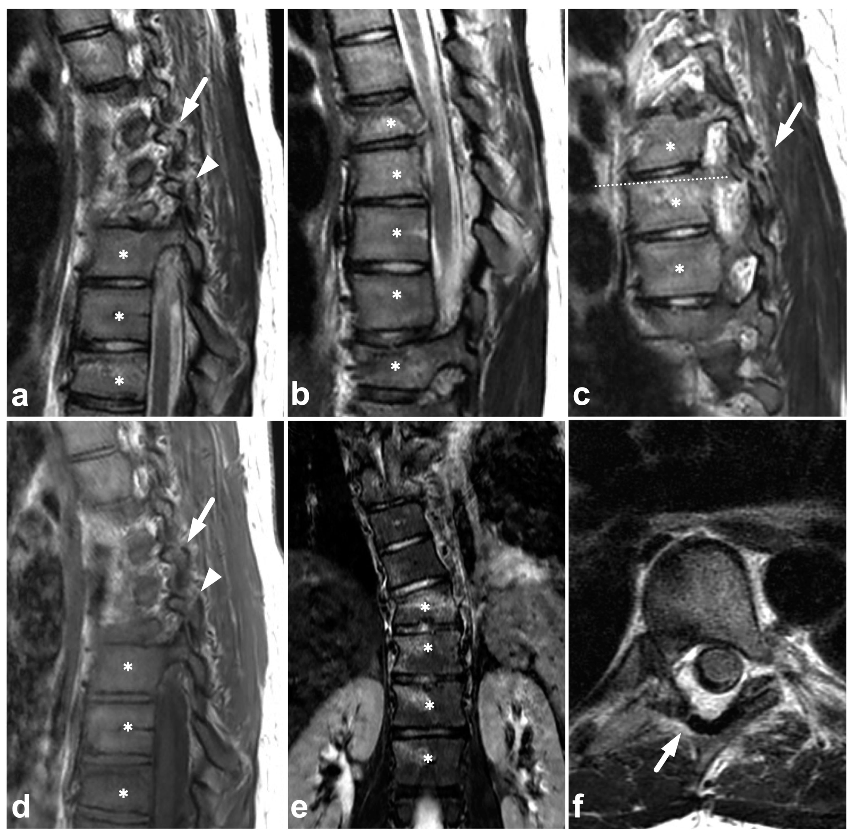 Children 10 01094 g007 Children 10 01094 g007