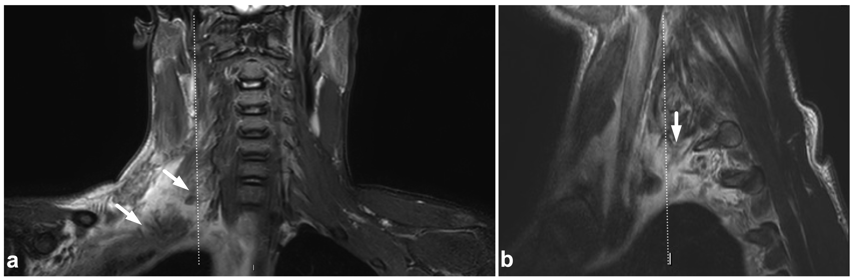 Children 10 01094 g013 Children 10 01094 g013