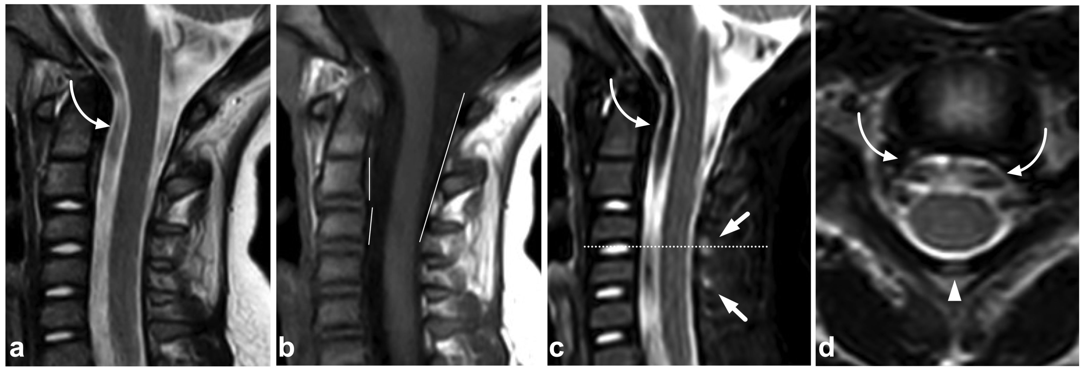 Children 10 01094 g017 Children 10 01094 g017