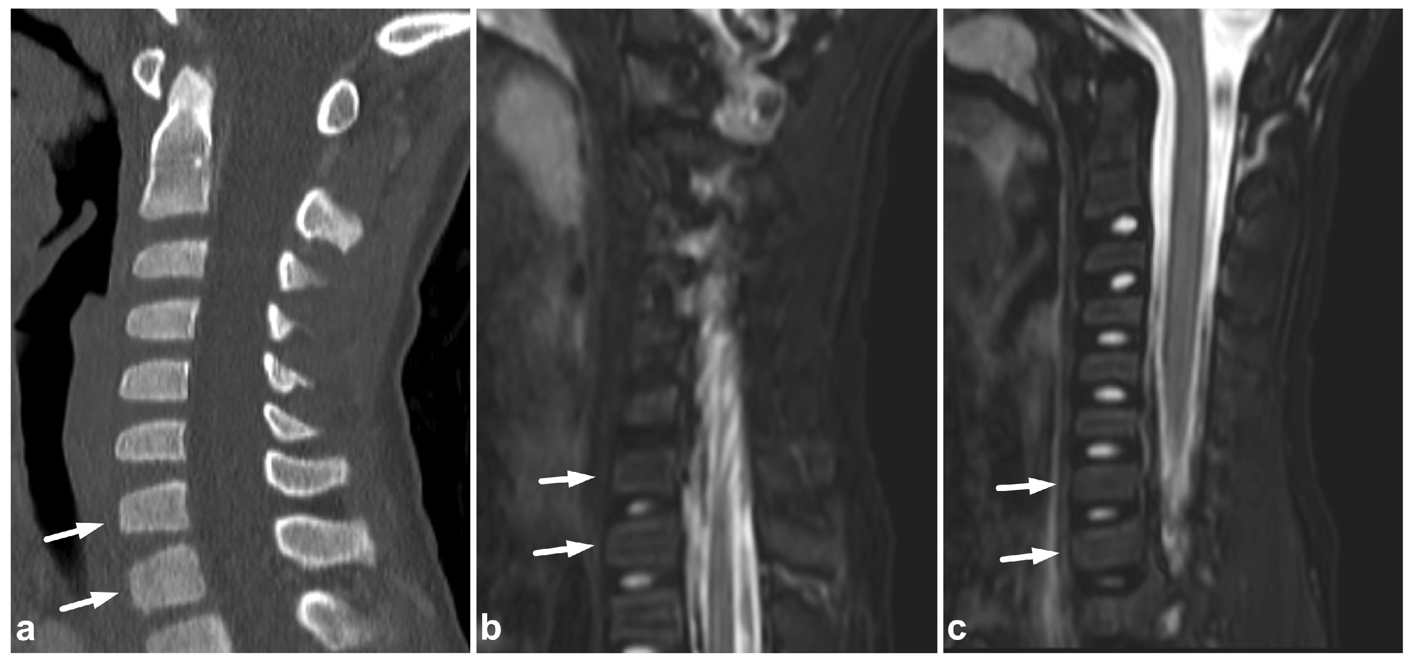 Children 10 01094 g018 Children 10 01094 g018