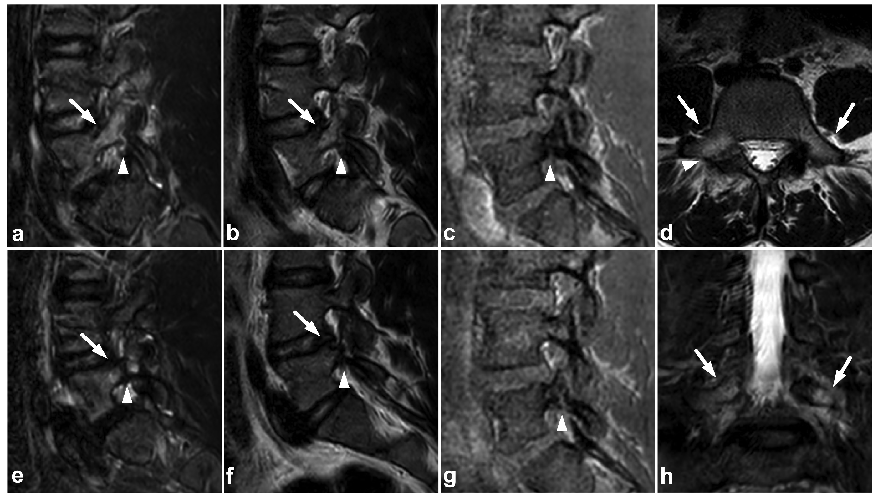 Children 10 01094 g019 Children 10 01094 g019