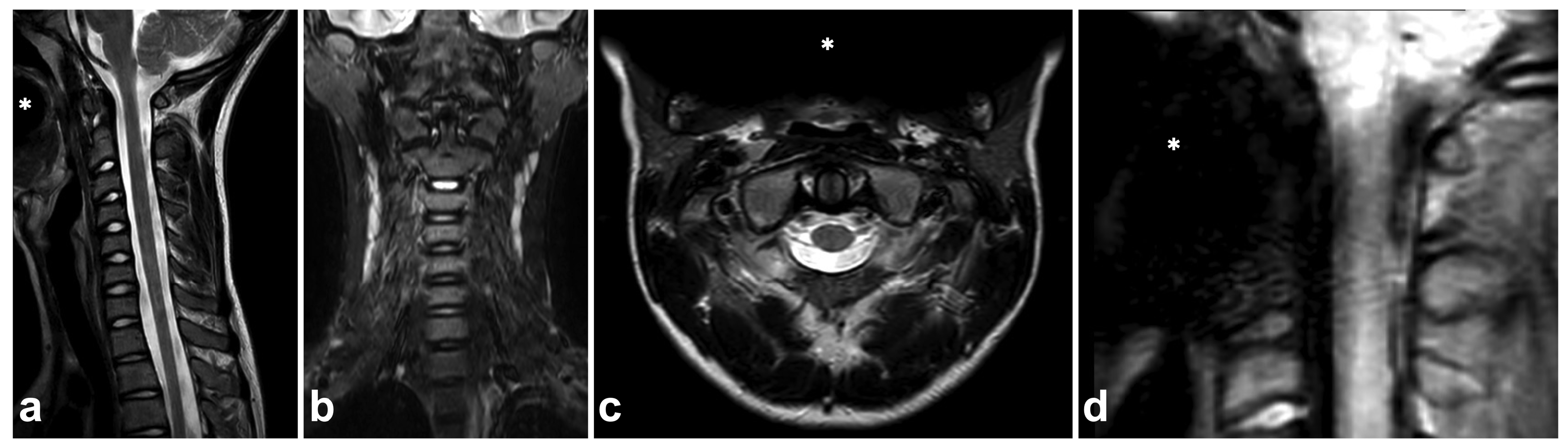 Children 10 01094 g023 Children 10 01094 g023