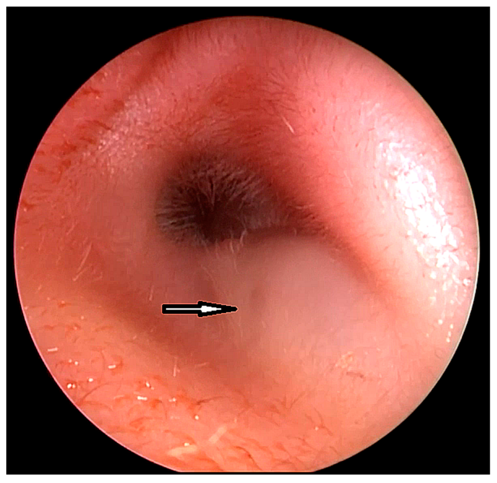 Children 10 01158 g001 Children 10 01158 g001