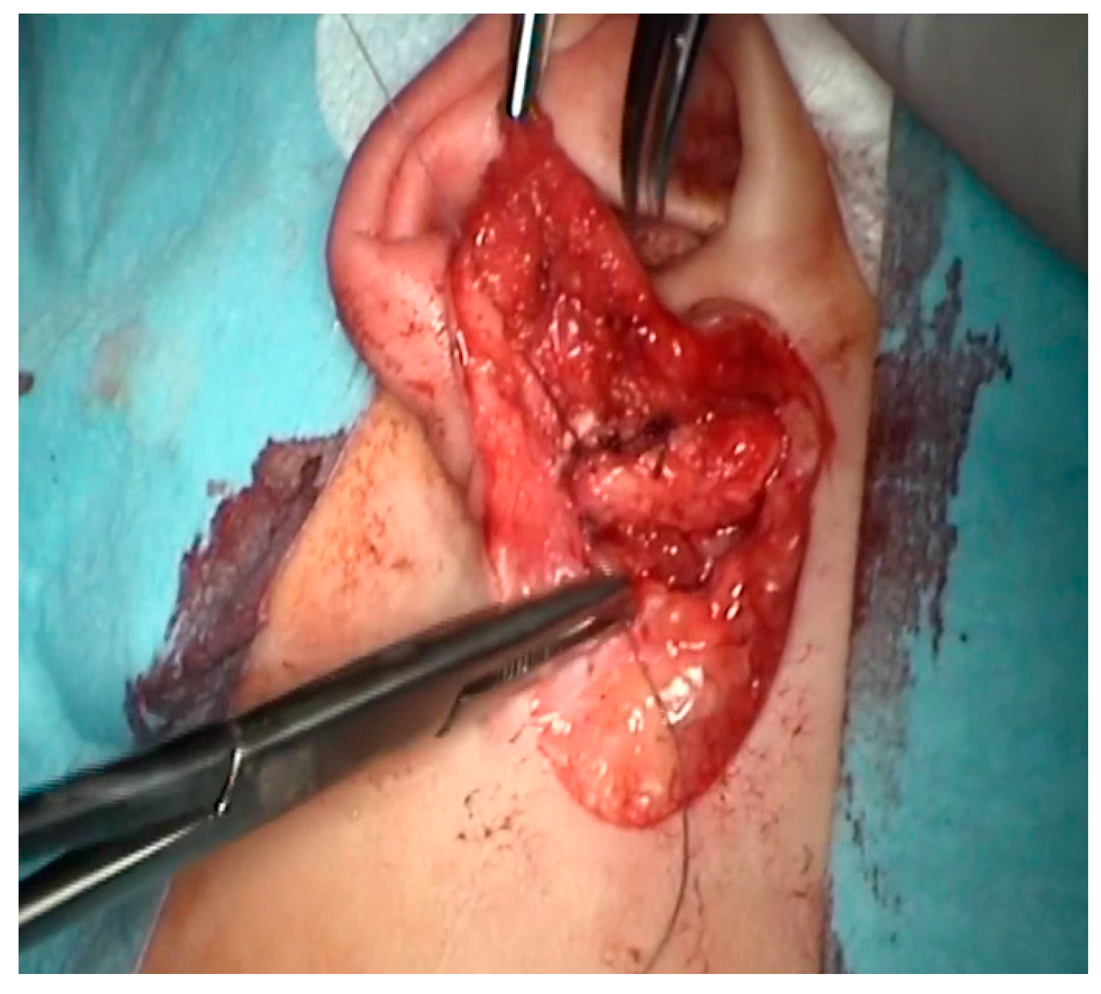 Children 10 01158 g007 Children 10 01158 g007