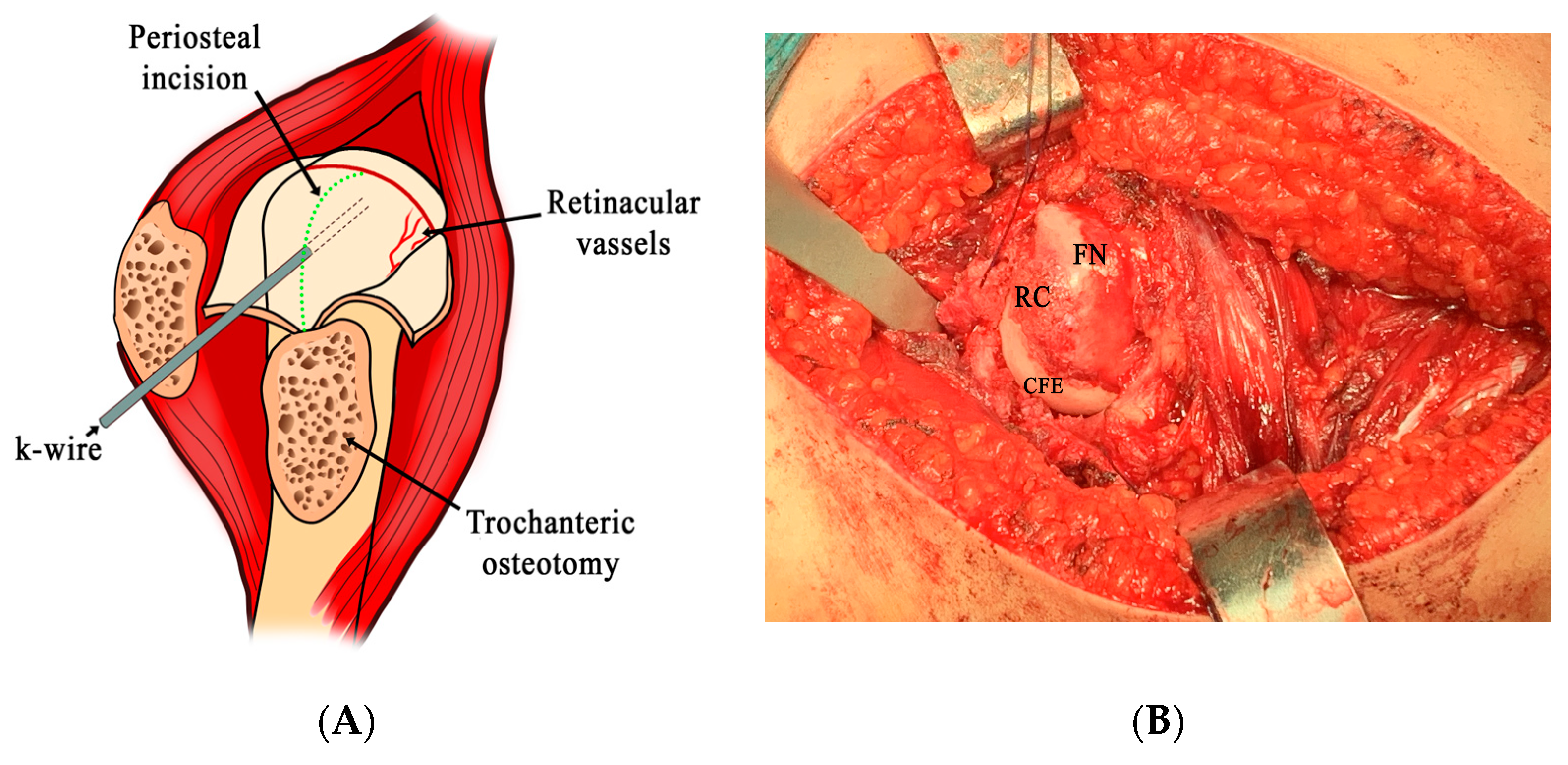 Children 10 01163 g001