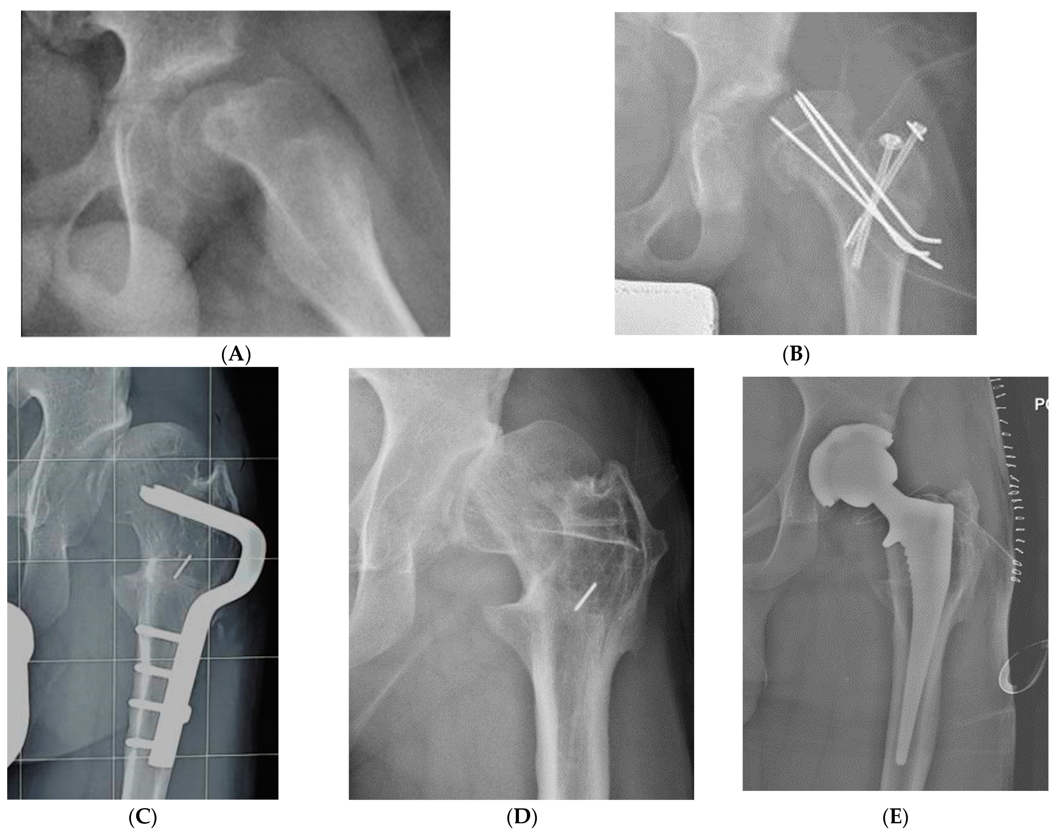 Children 10 01163 g005