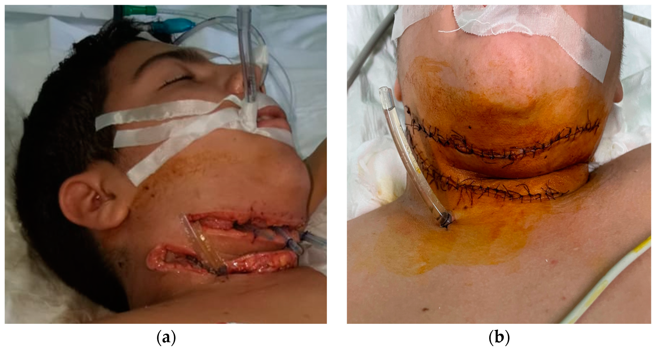 Children 10 01262 g003